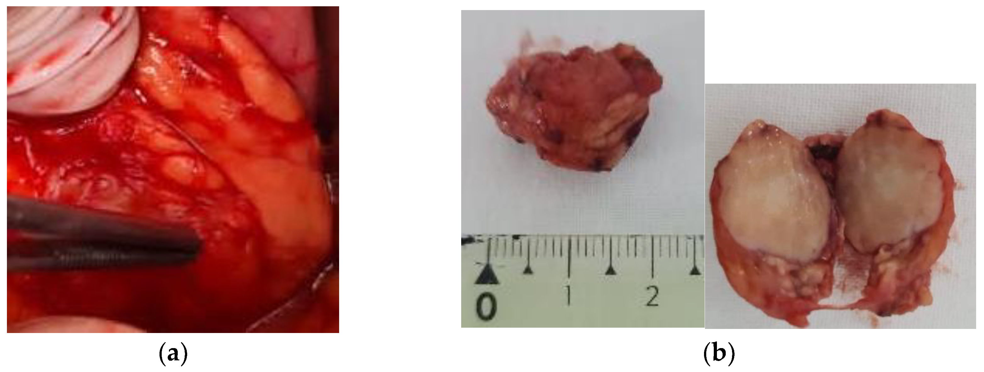 Diagnostics 15 00337 g002