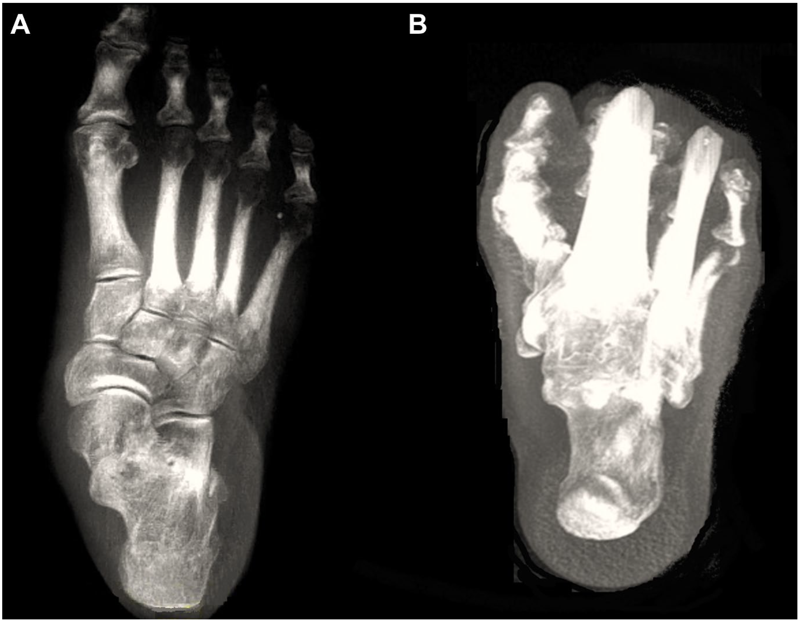 Diagnostics 15 00343 g001