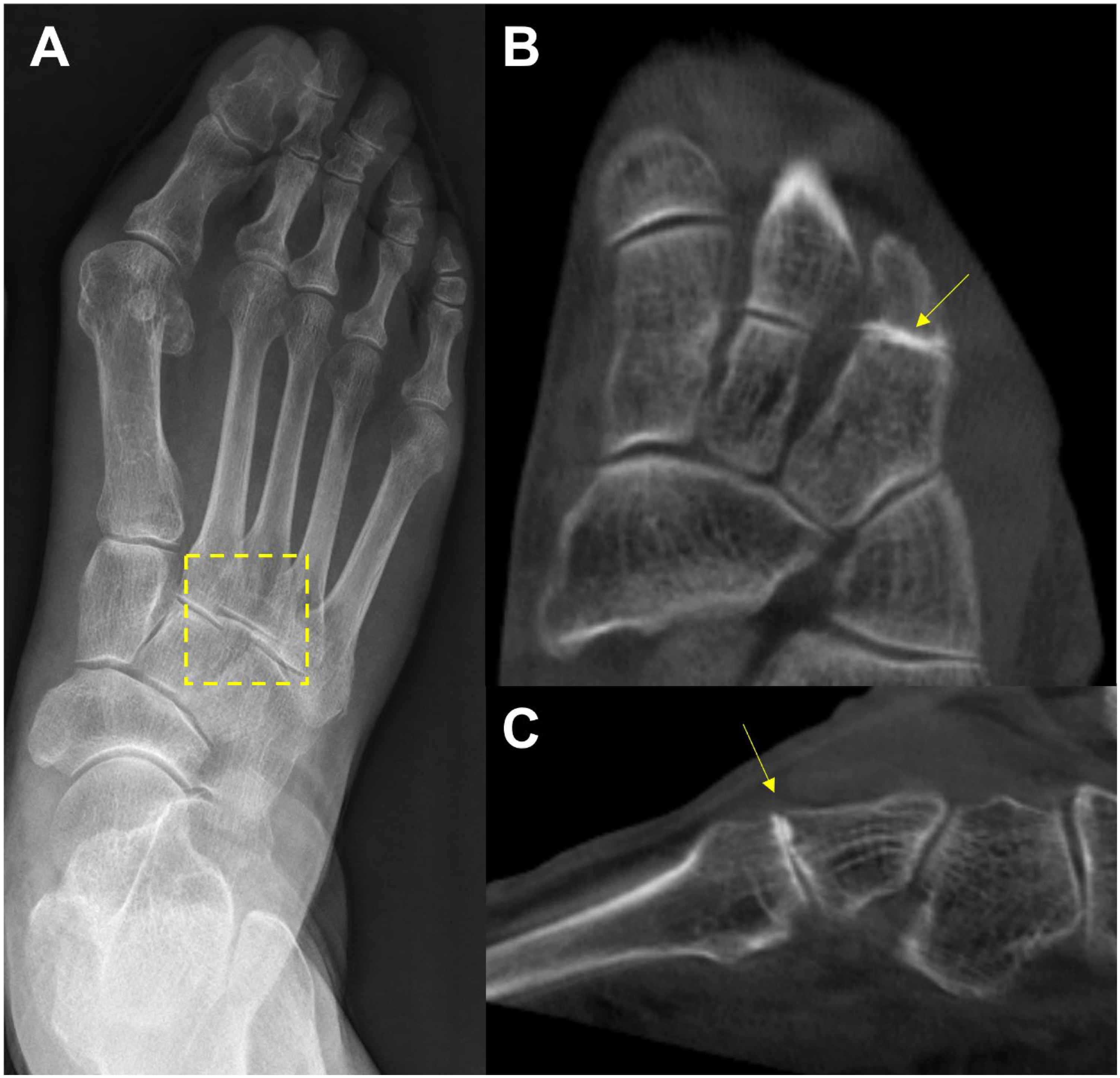 Diagnostics 15 00343 g006