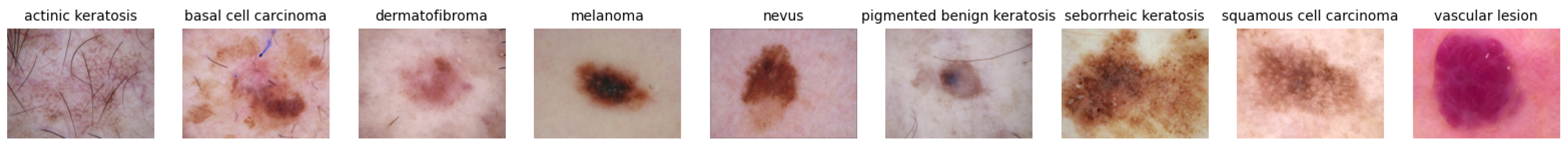 Diagnostics 15 00352 g006