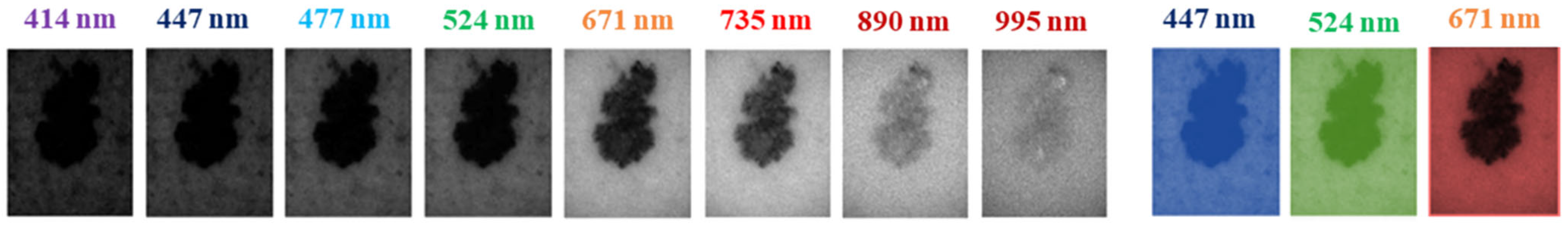 Diagnostics 15 00355 g002