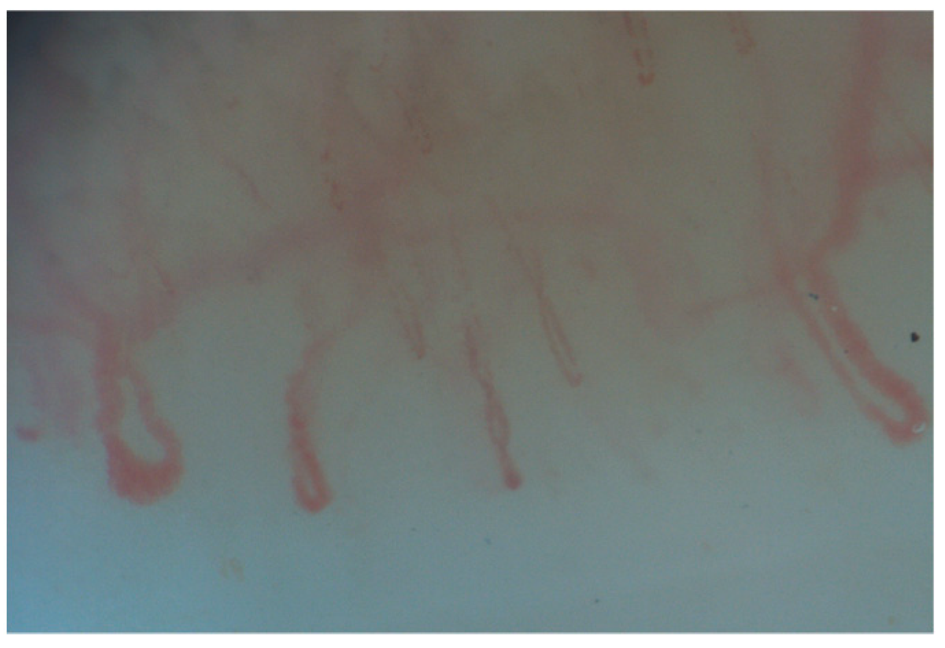 Diagnostics 15 00362 g006 Diagnostics 15 00362 g006