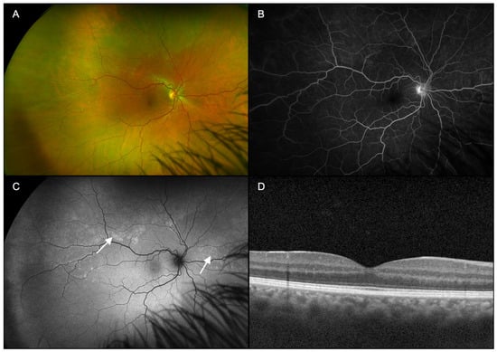 Diagnostics 15 00369 g001