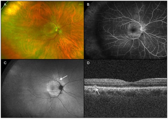 Diagnostics 15 00369 g003