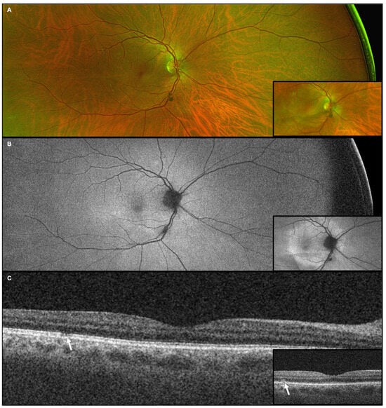 Diagnostics 15 00369 g004