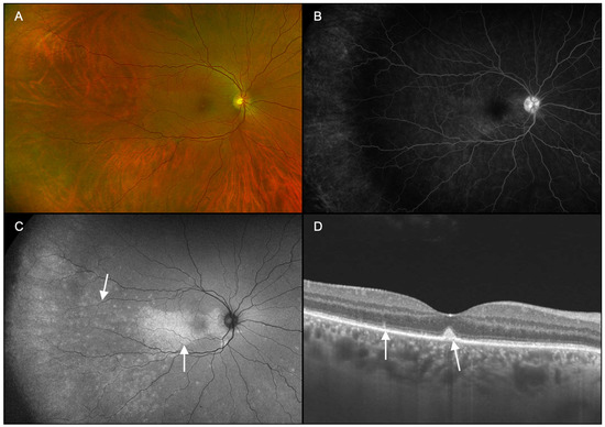 Diagnostics 15 00369 g005