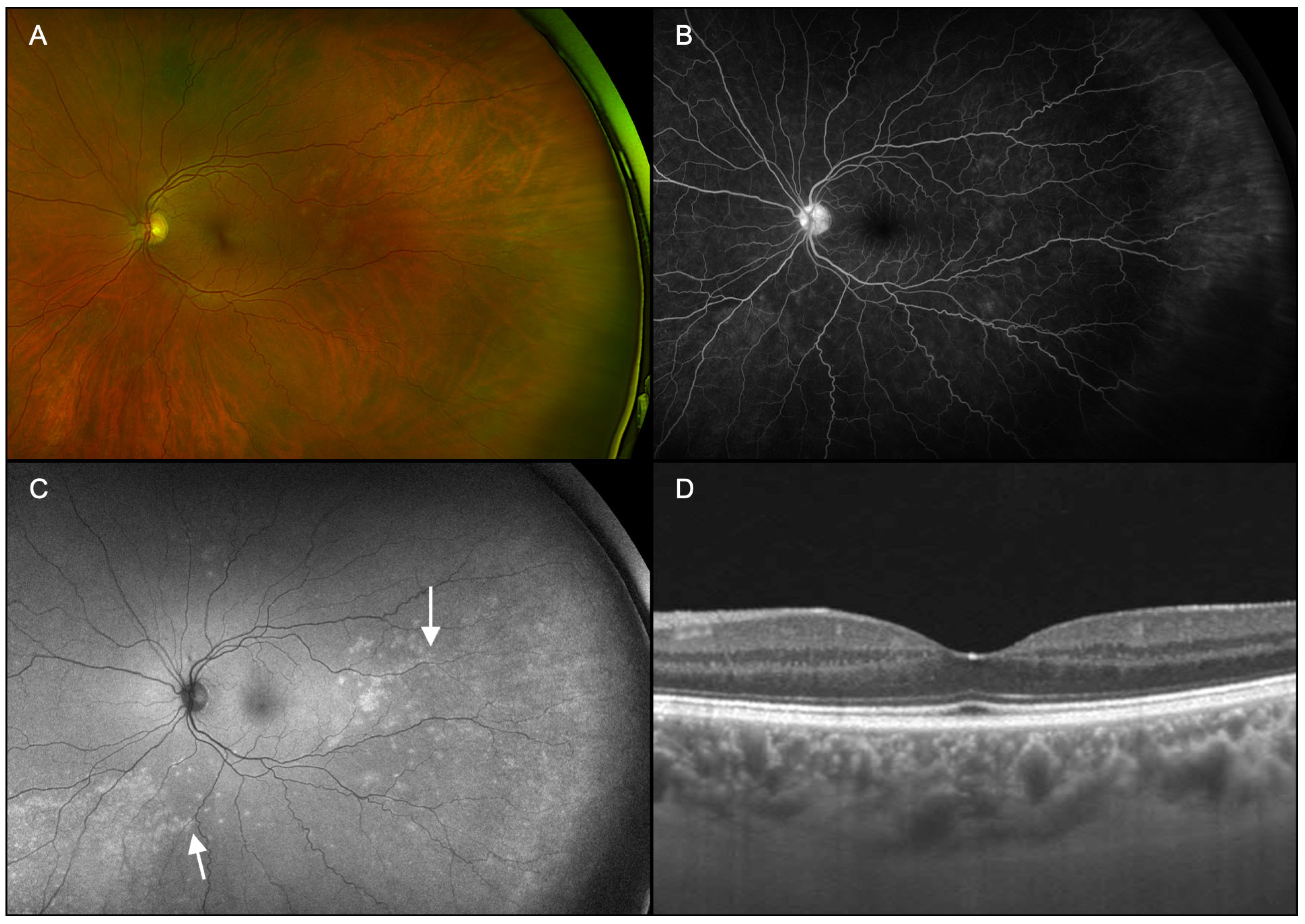 Diagnostics 15 00369 g006