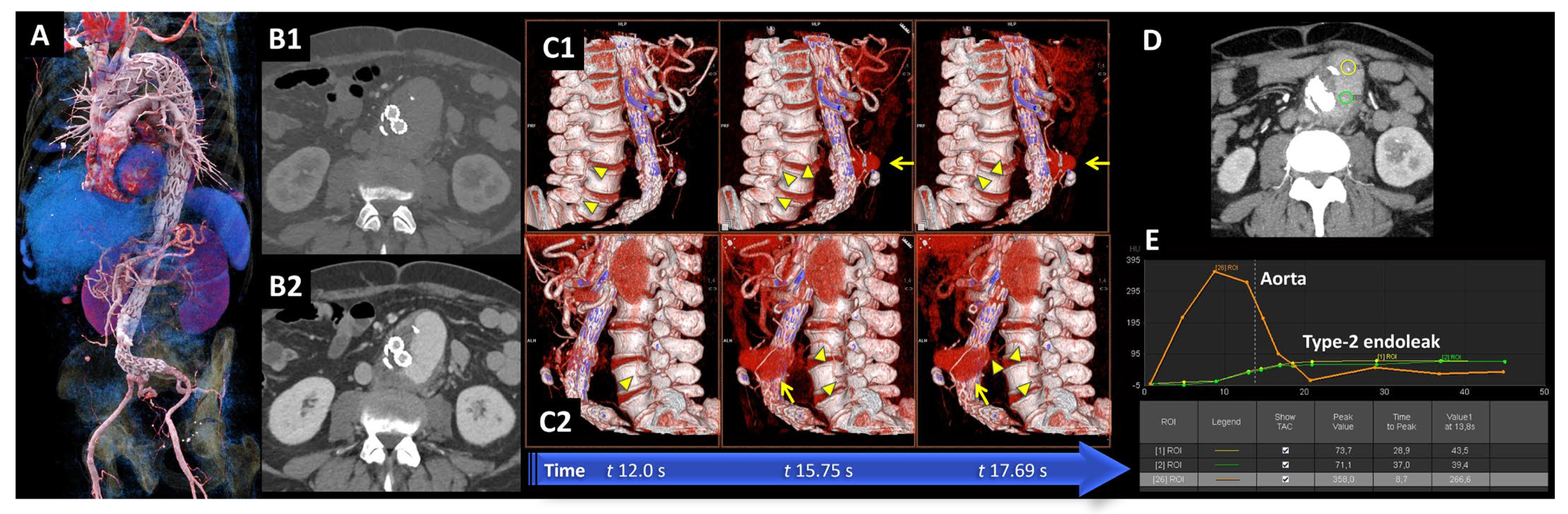 Diagnostics 15 00370 g002