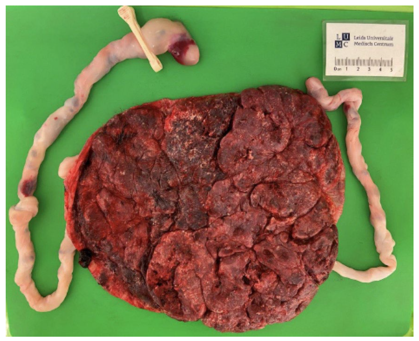 Diagnostics 15 00372 g003