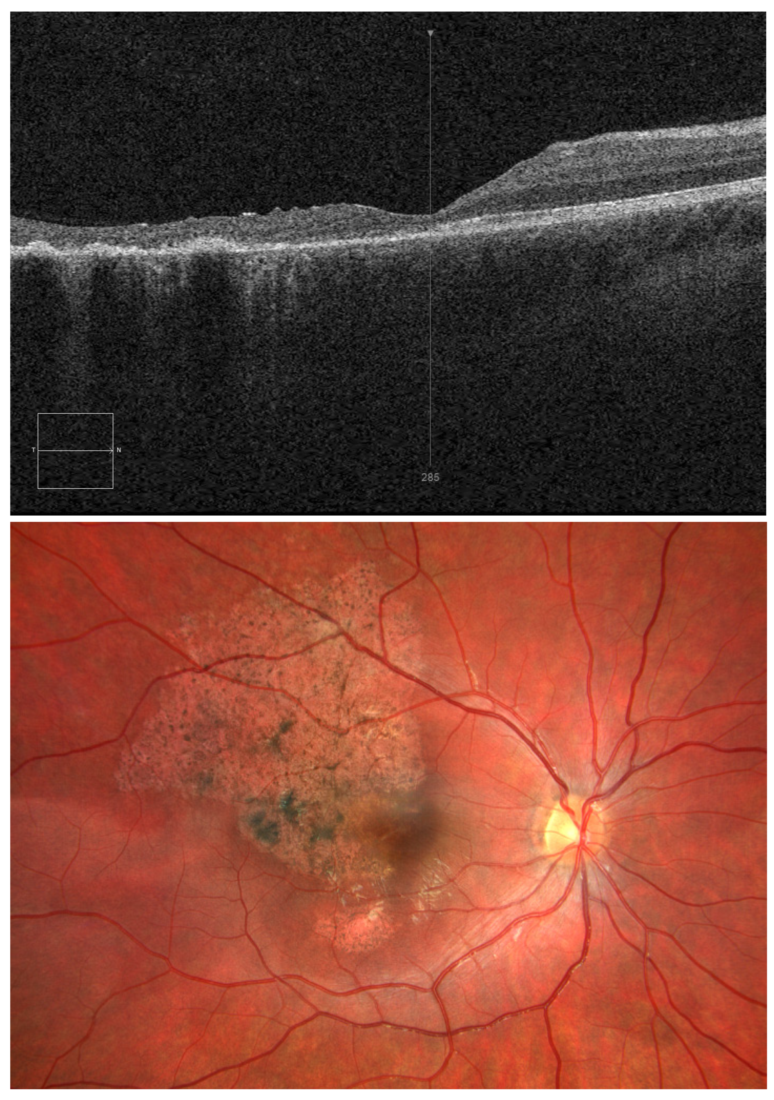 Diagnostics 15 00400 g003