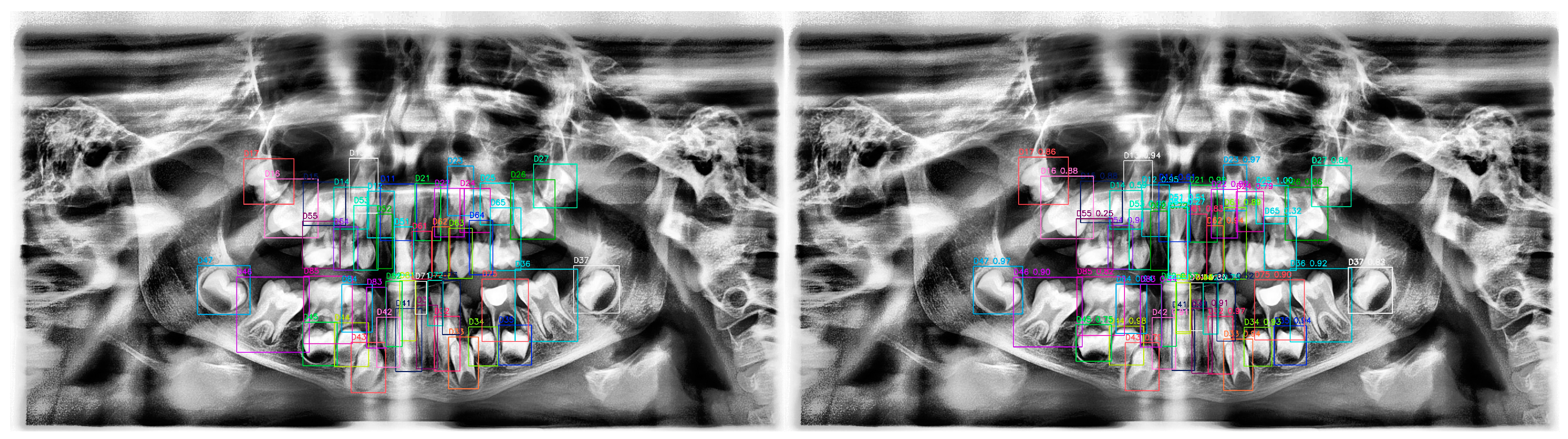 Diagnostics 15 00405 g010