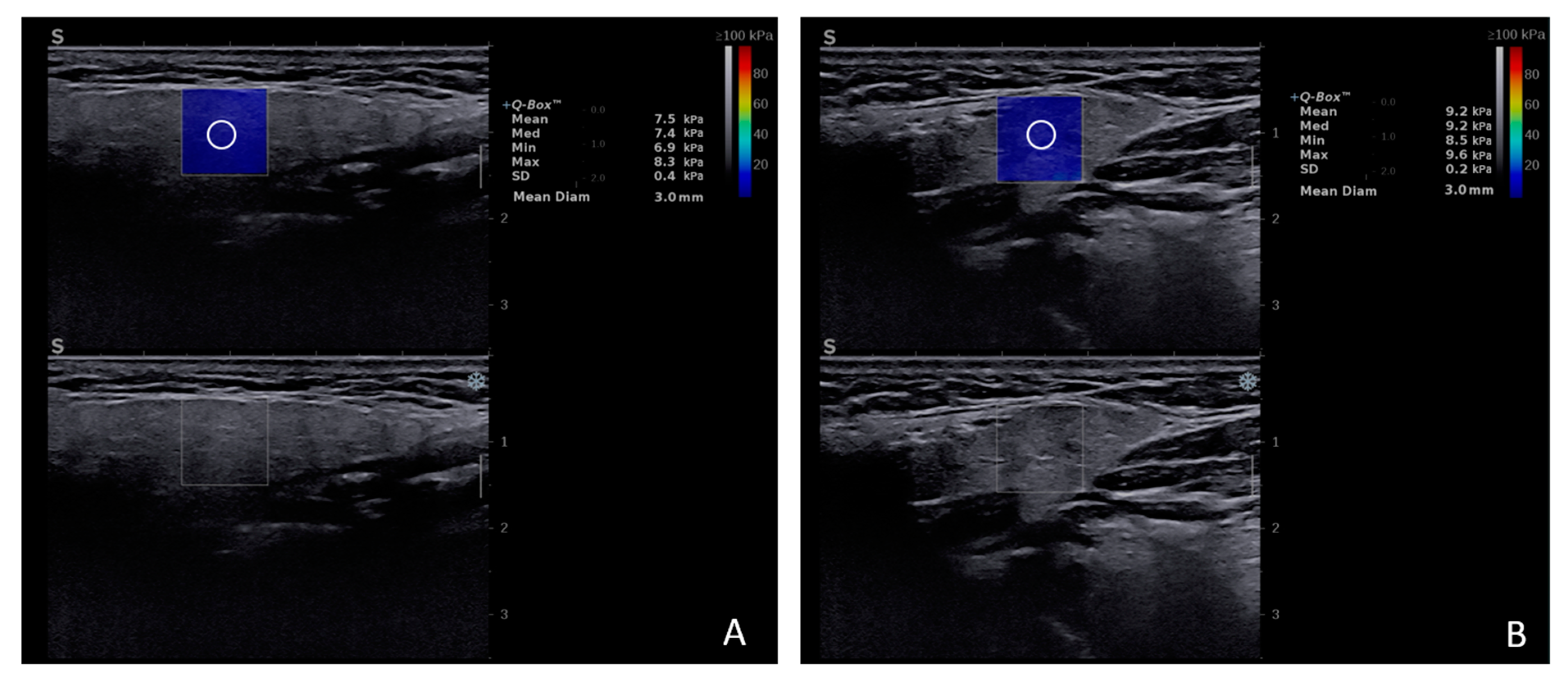 Diagnostics 15 00411 g002