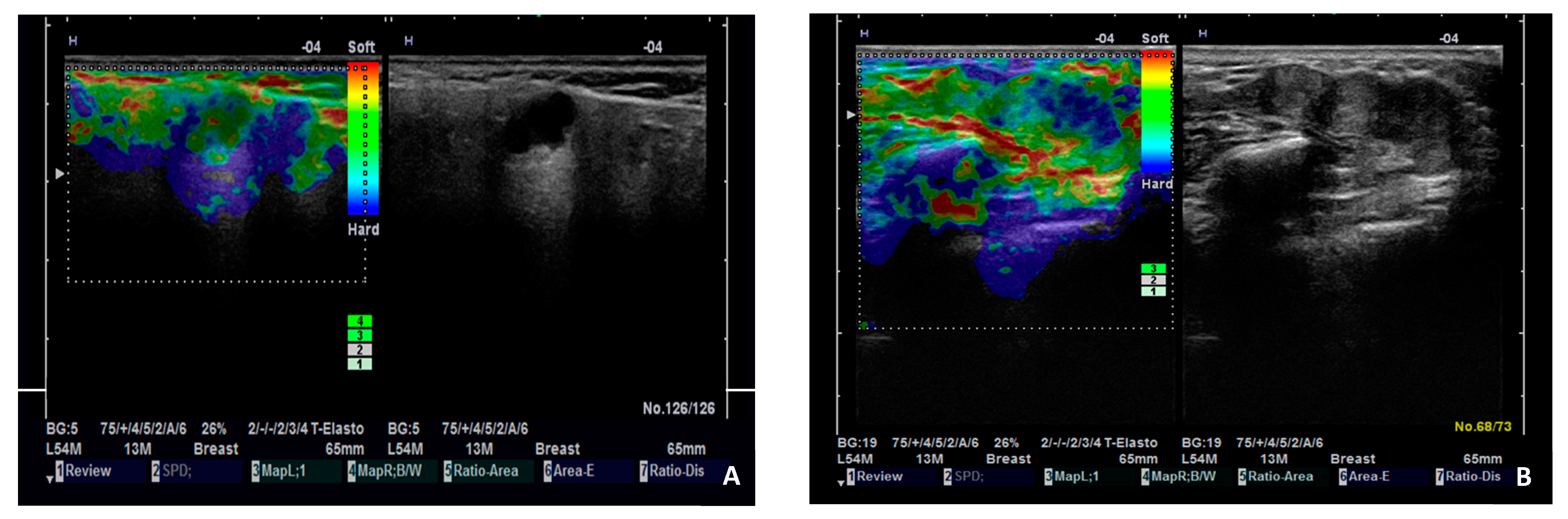 Diagnostics 15 00411 g004