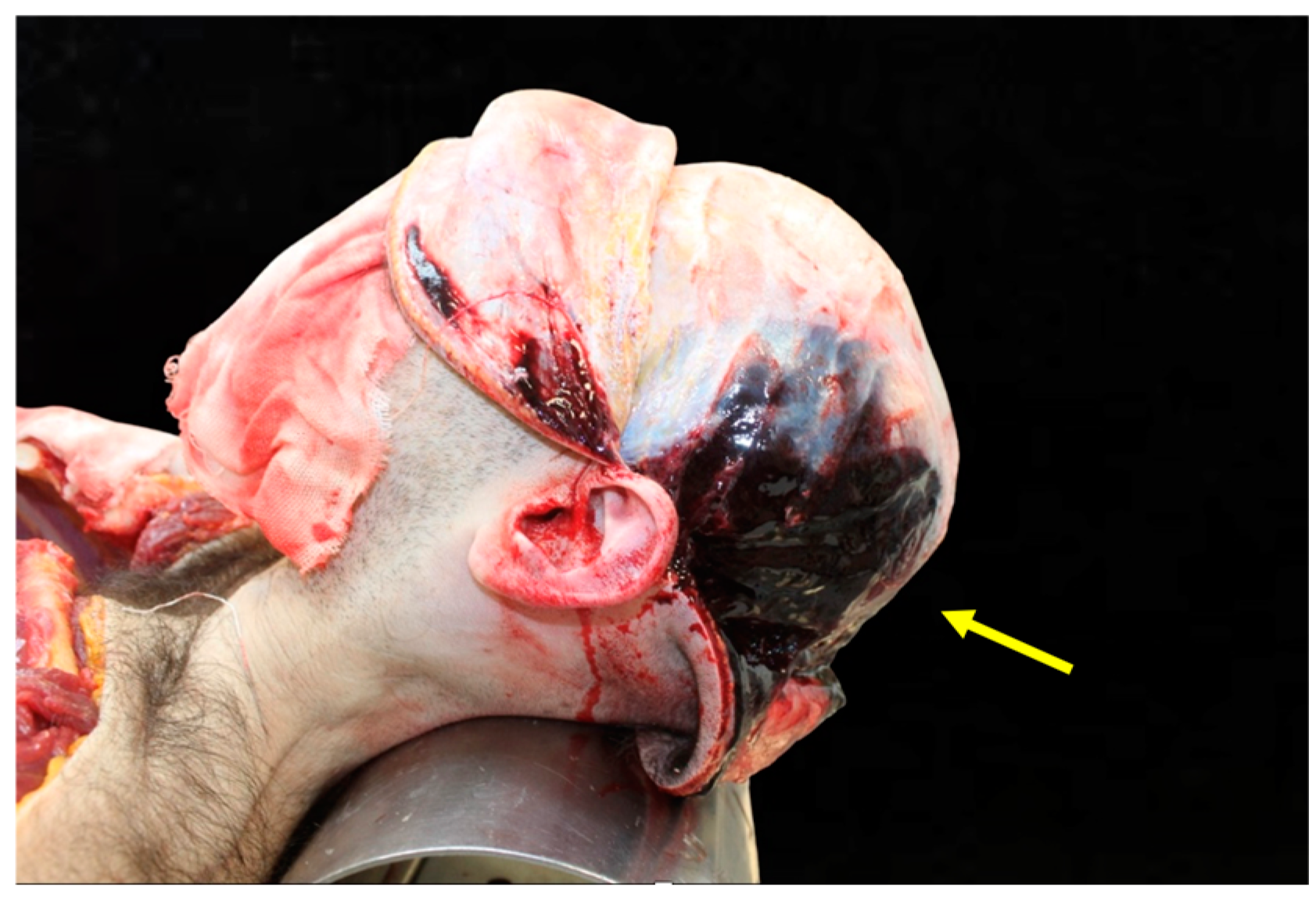 Diagnostics 15 00442 g003