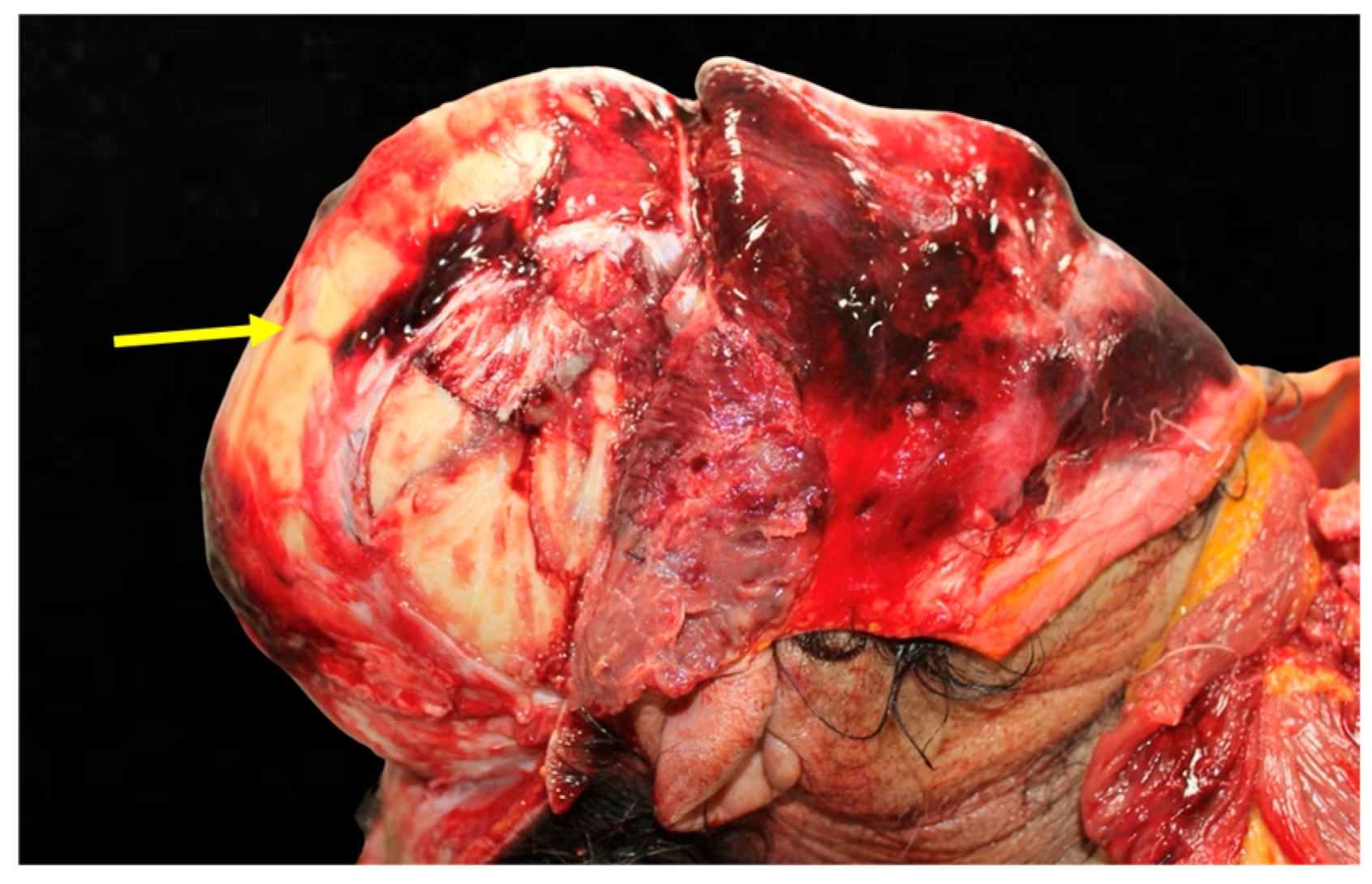 Diagnostics 15 00442 g005