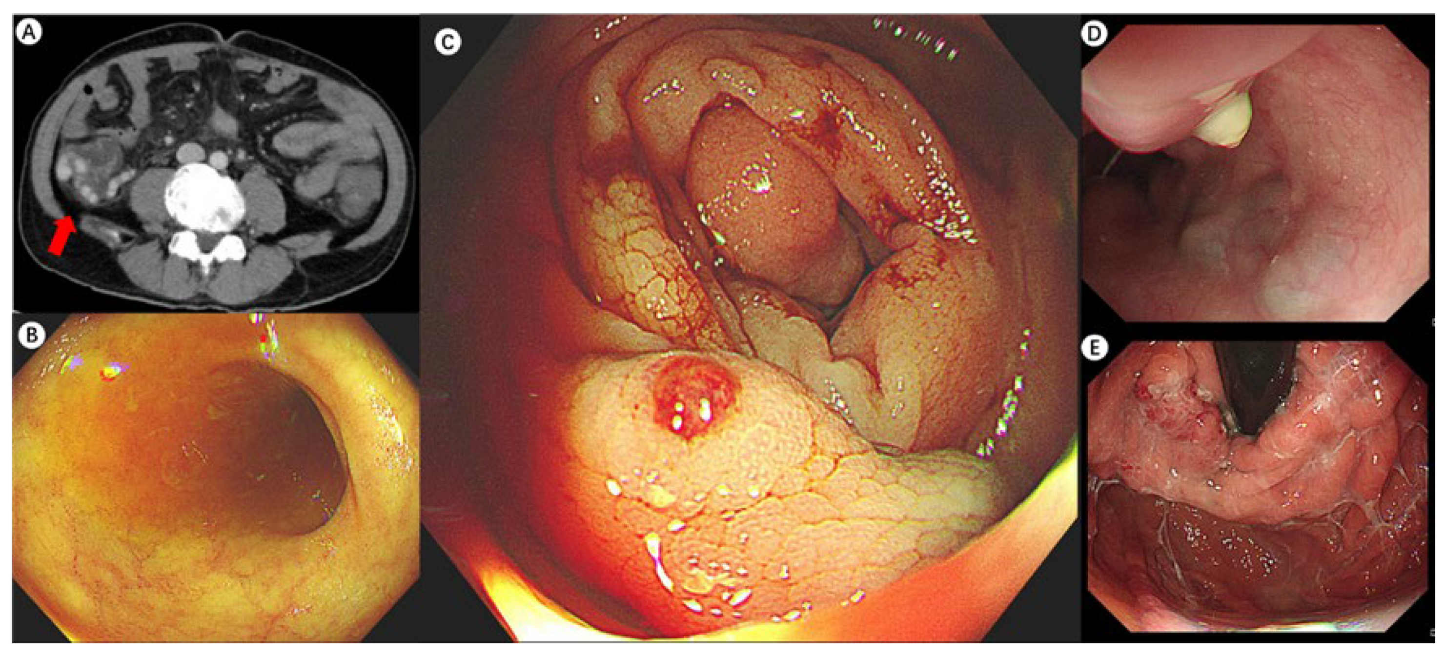 Diagnostics 15 00461 g001