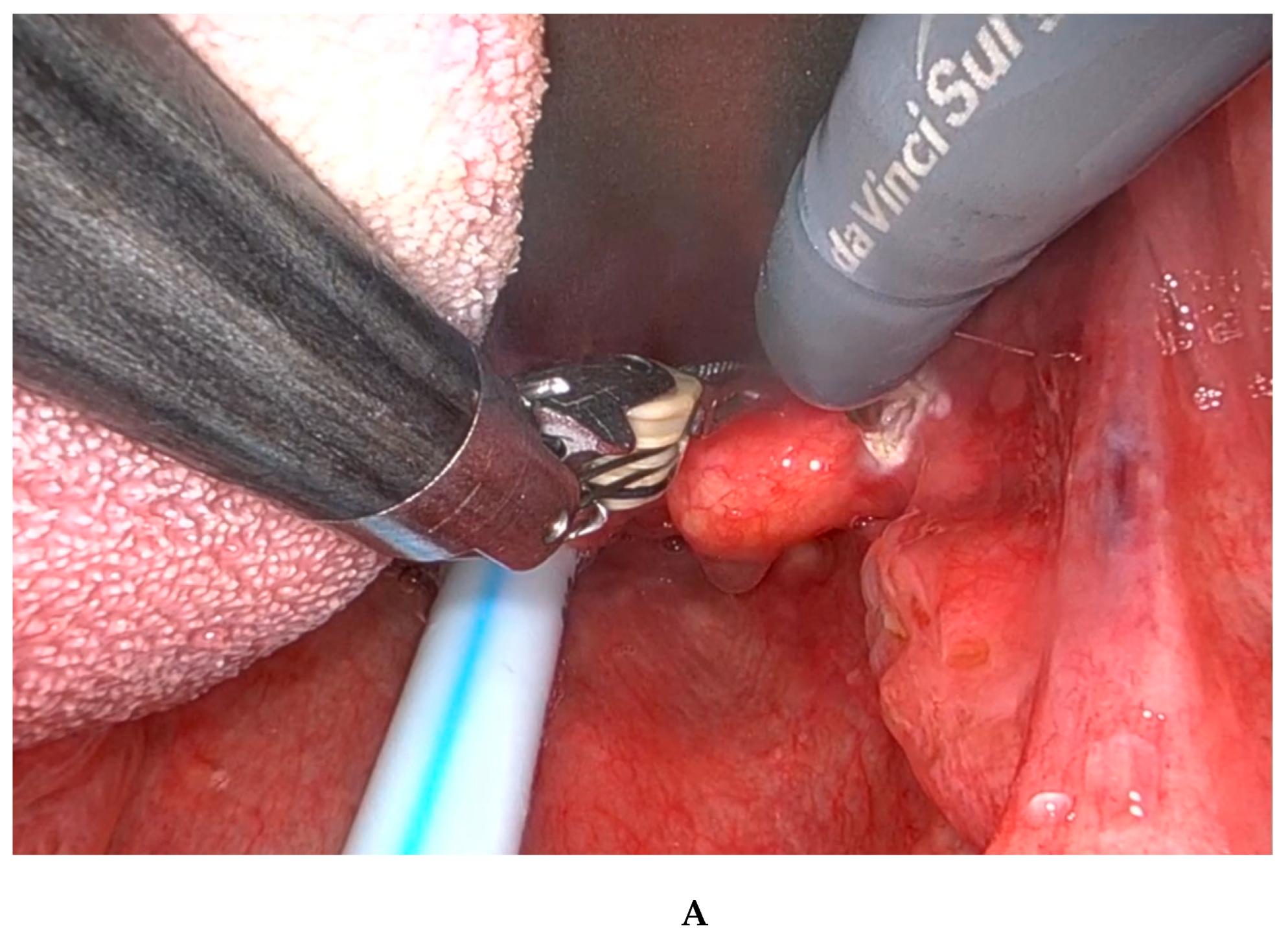 Diagnostics 15 00484 g002a