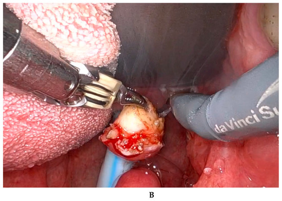 Diagnostics 15 00484 g002b