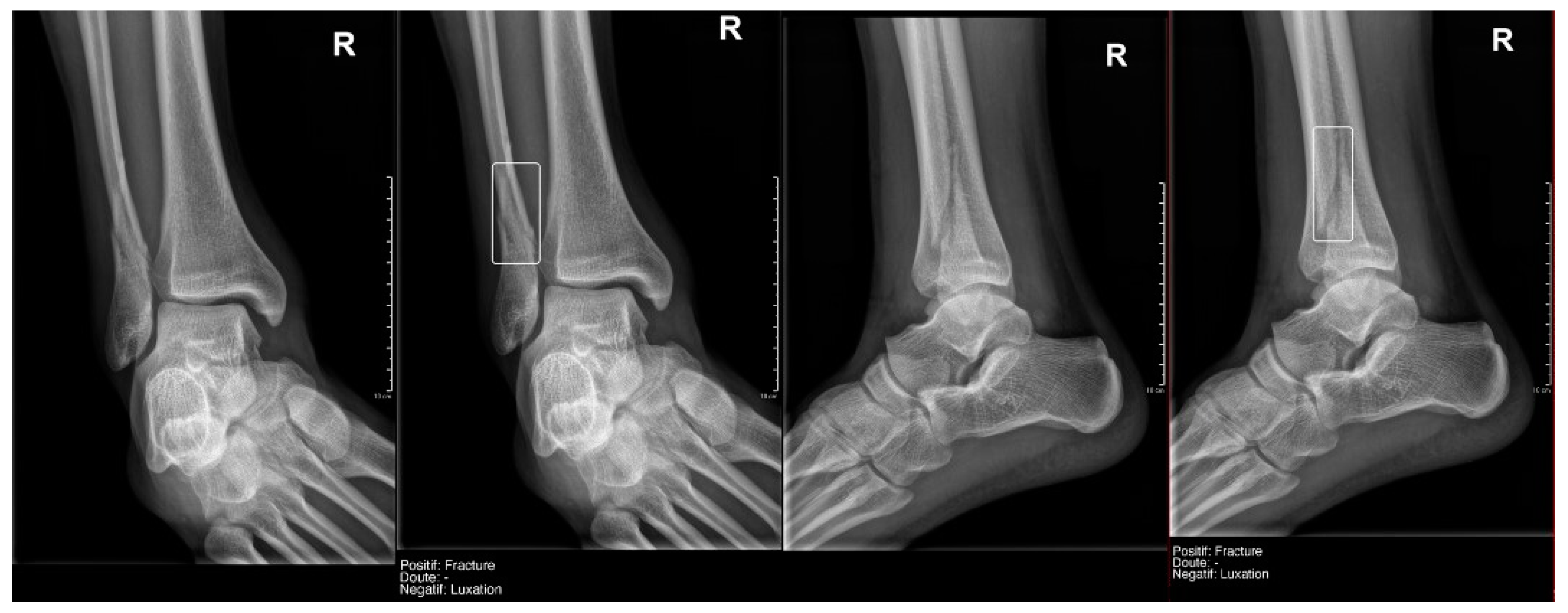 Diagnostics 15 00491 g005