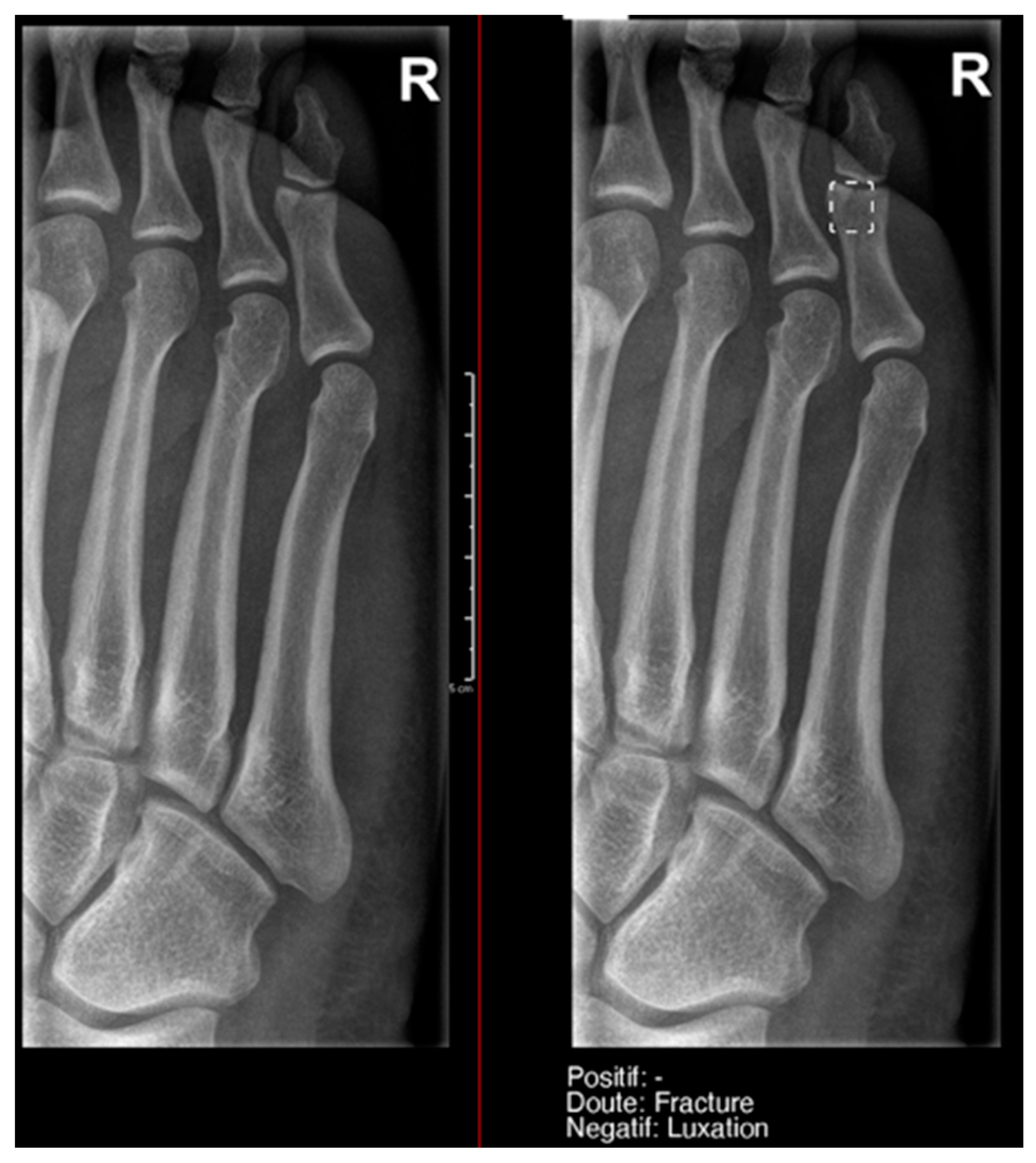 Diagnostics 15 00491 g006