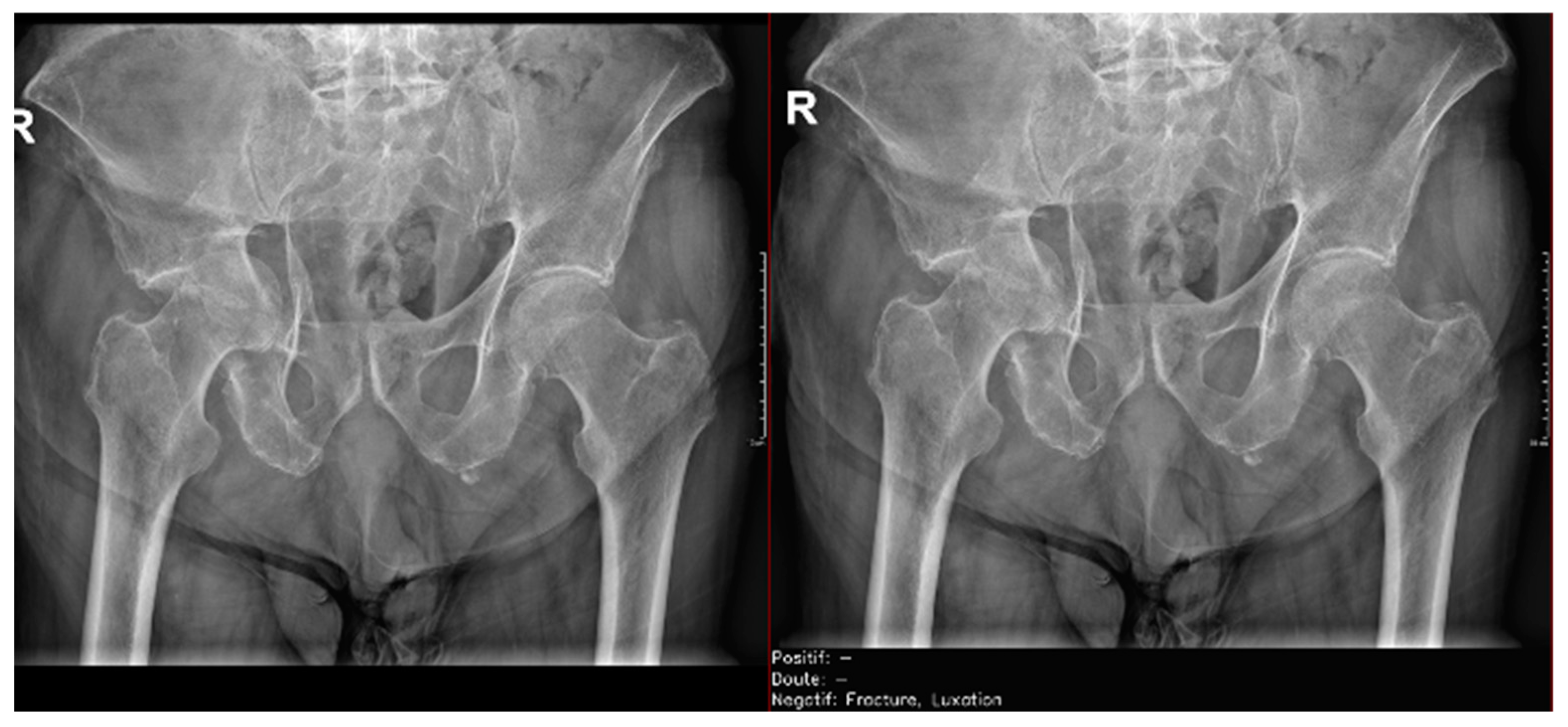 Diagnostics 15 00491 g010
