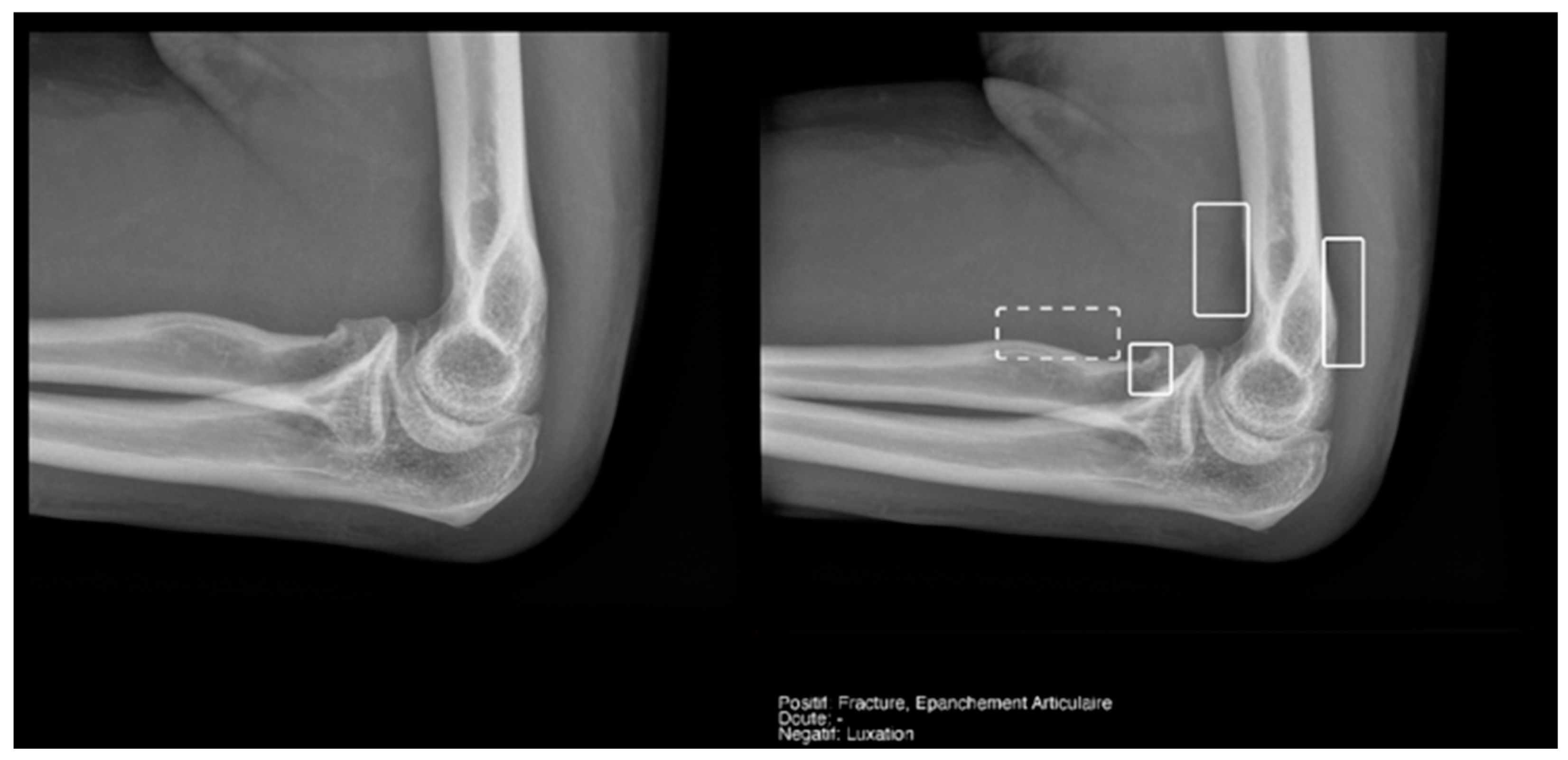 Diagnostics 15 00491 g012