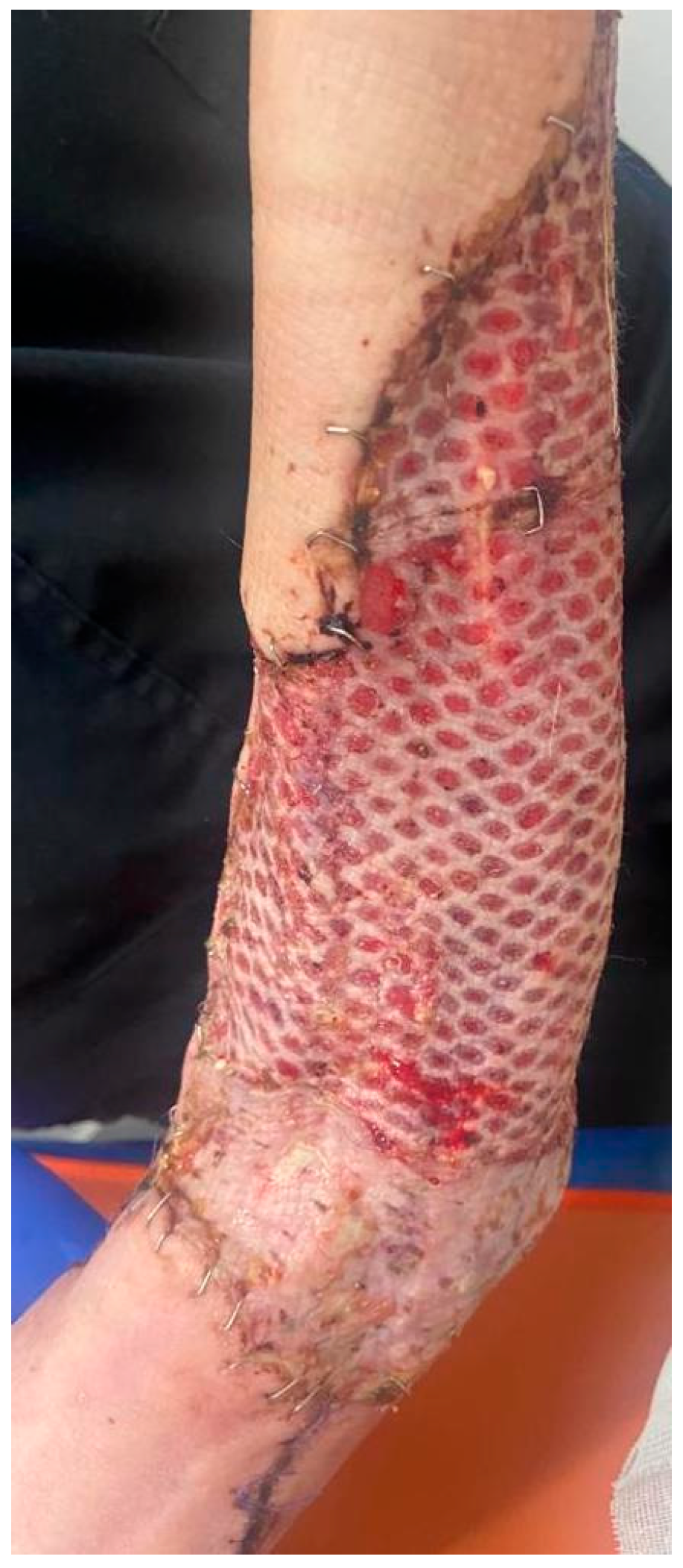 Diagnostics 15 00495 g004