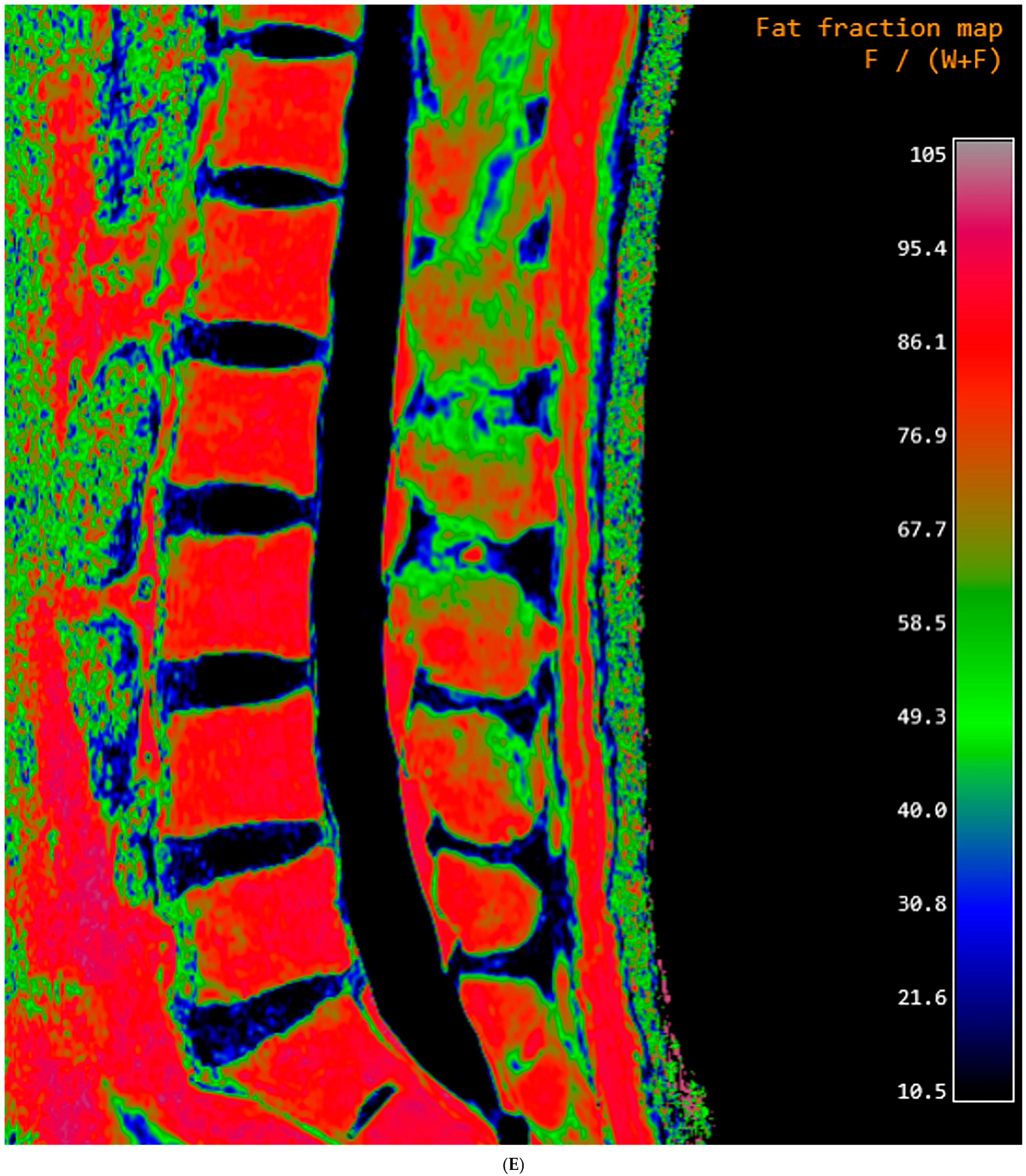 Diagnostics 15 00503 g001e