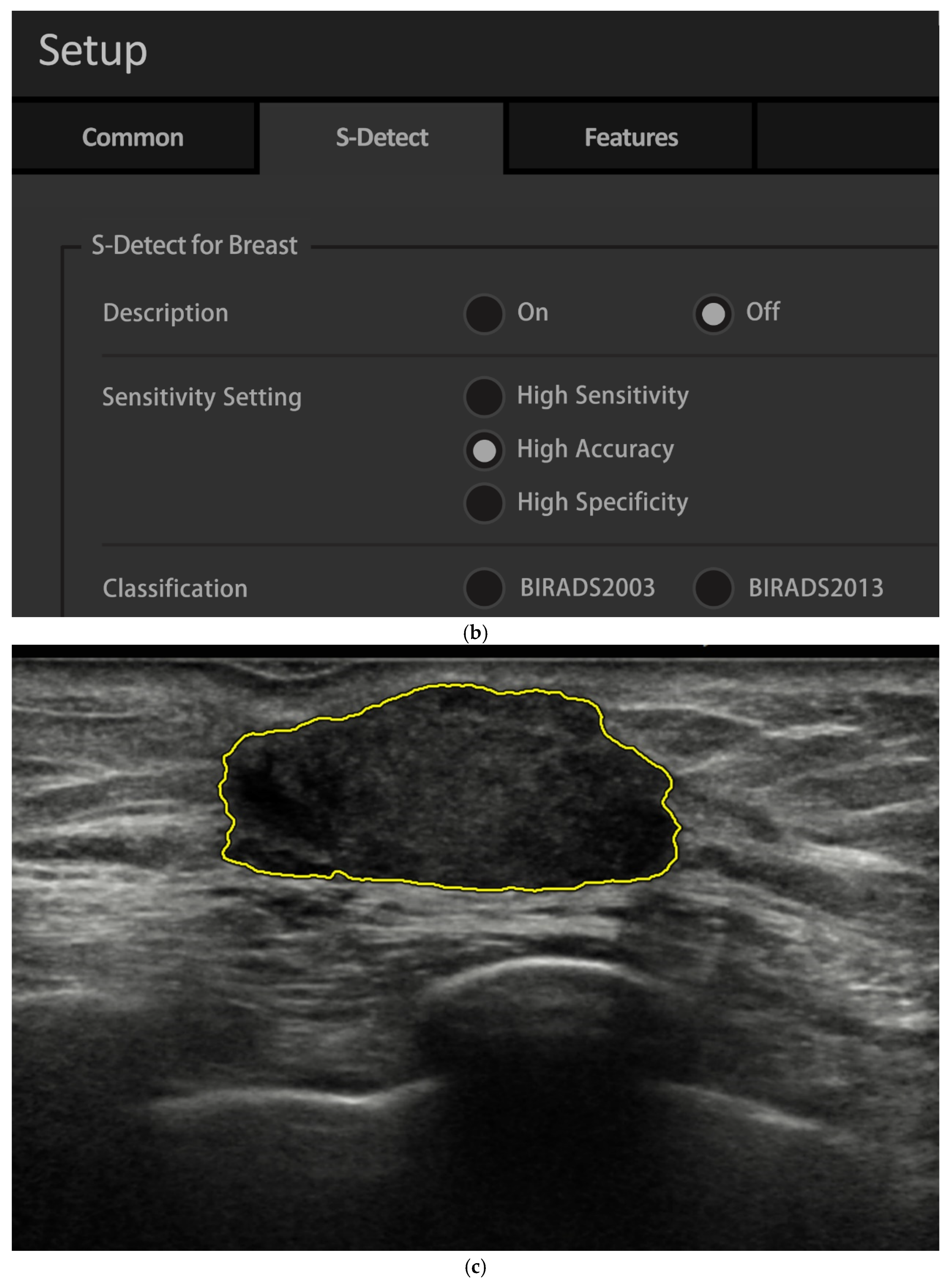 Diagnostics 15 00560 g002b Diagnostics 15 00560 g002b