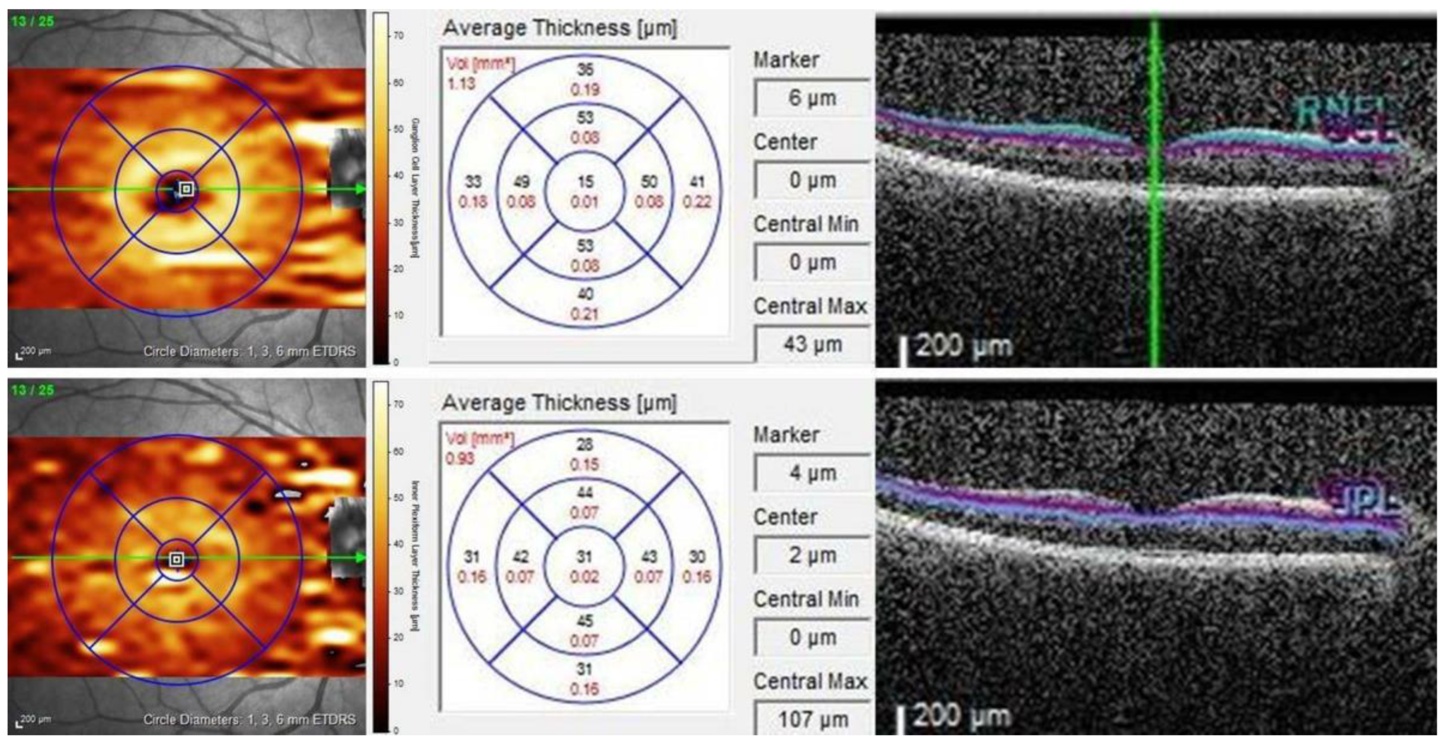 Diagnostics 15 00572 g001 Diagnostics 15 00572 g001