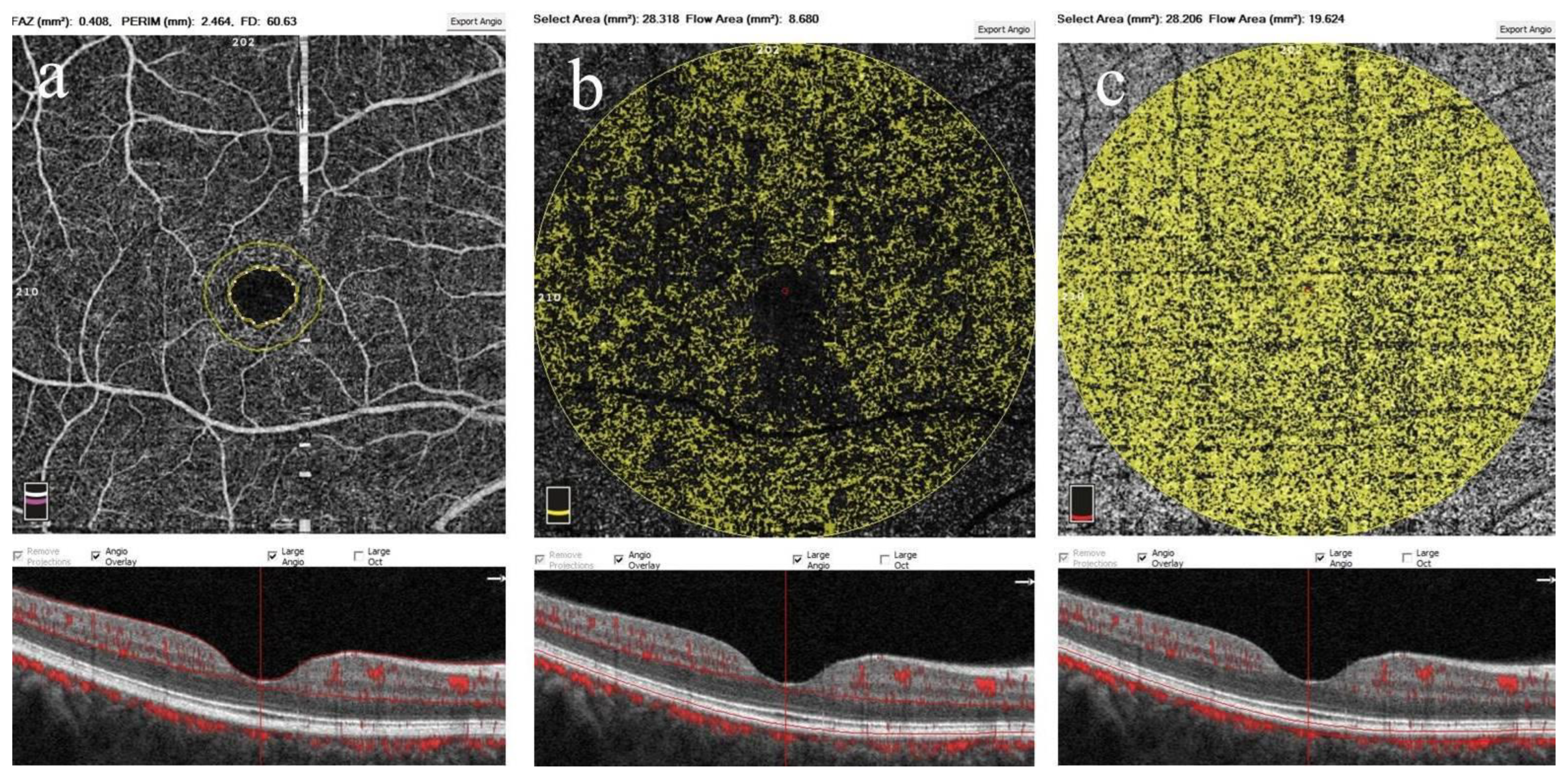 Diagnostics 15 00572 g003 Diagnostics 15 00572 g003