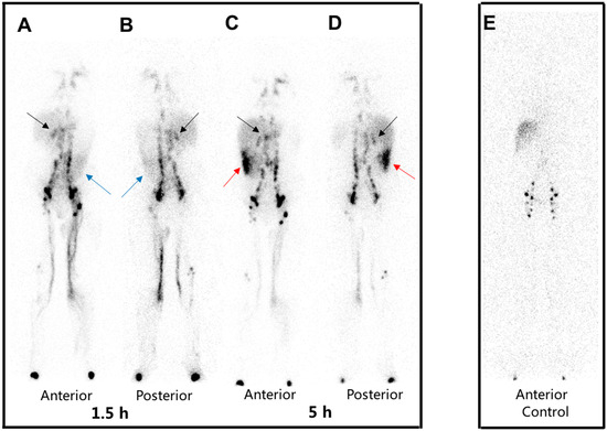 Diagnostics 15 00583 g001