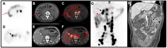 Diagnostics 15 00583 g002