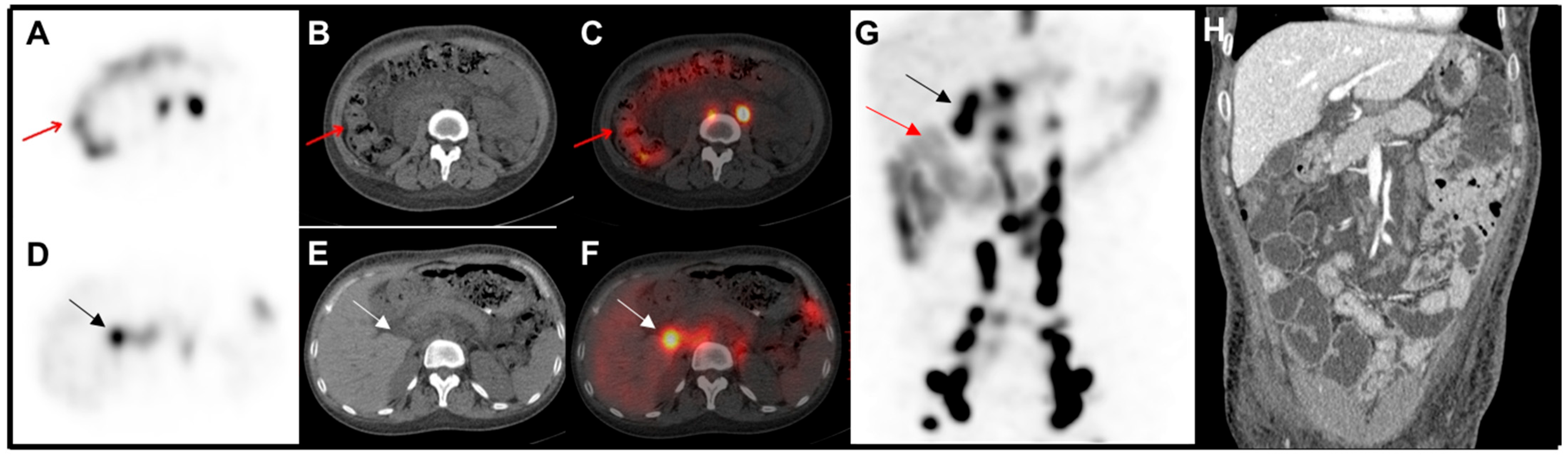 Diagnostics 15 00583 g002