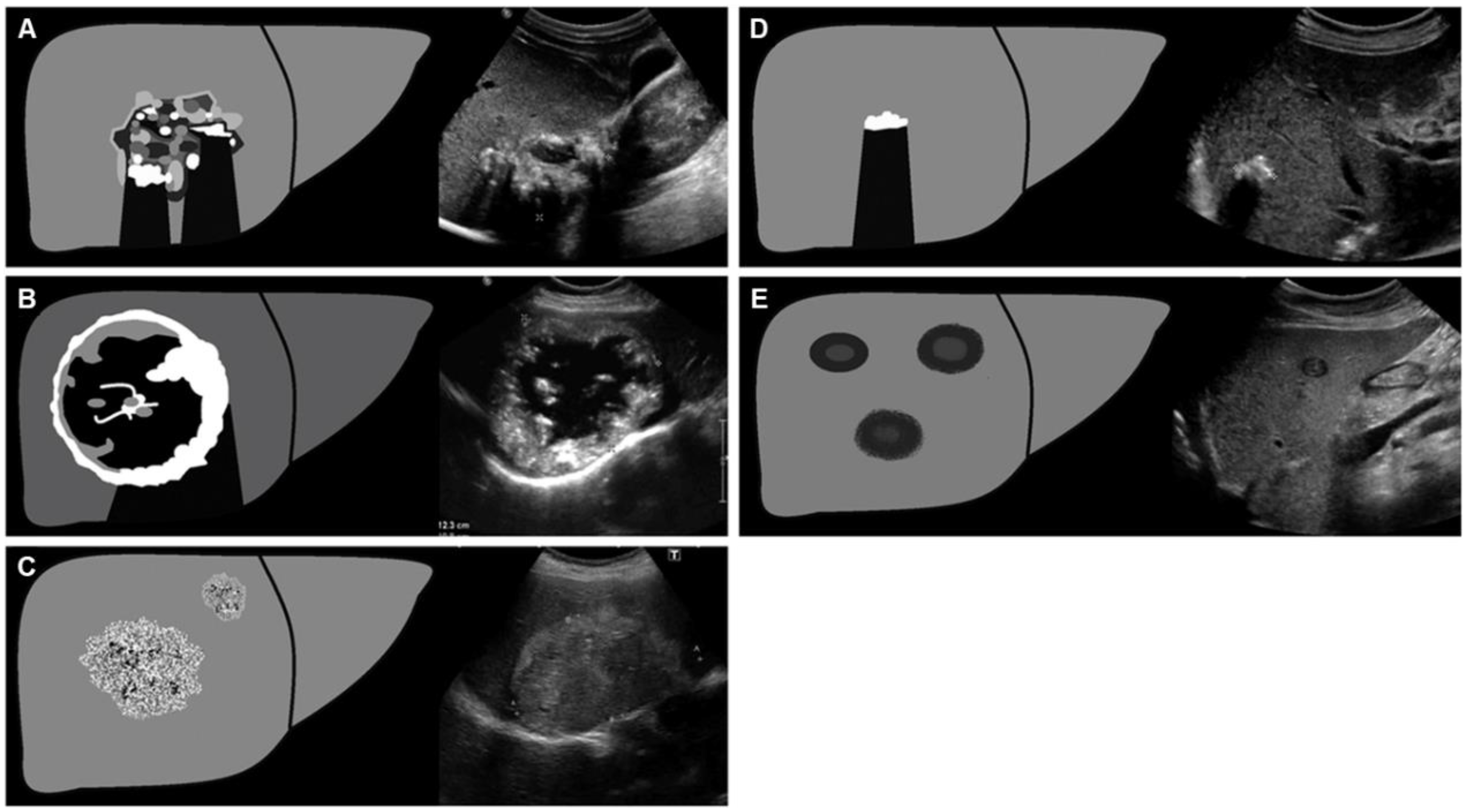 Diagnostics 15 00585 g004