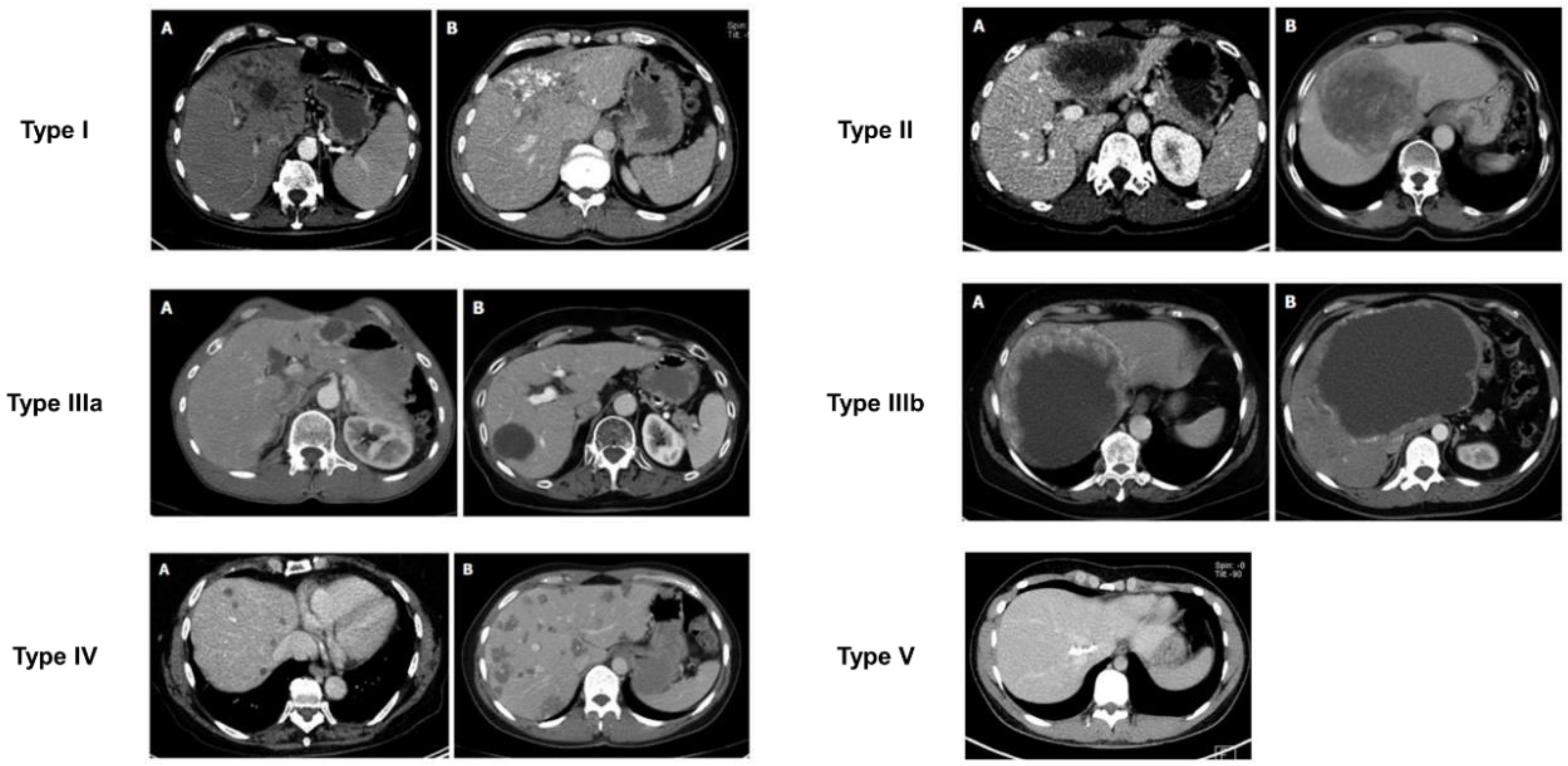 Diagnostics 15 00585 g005