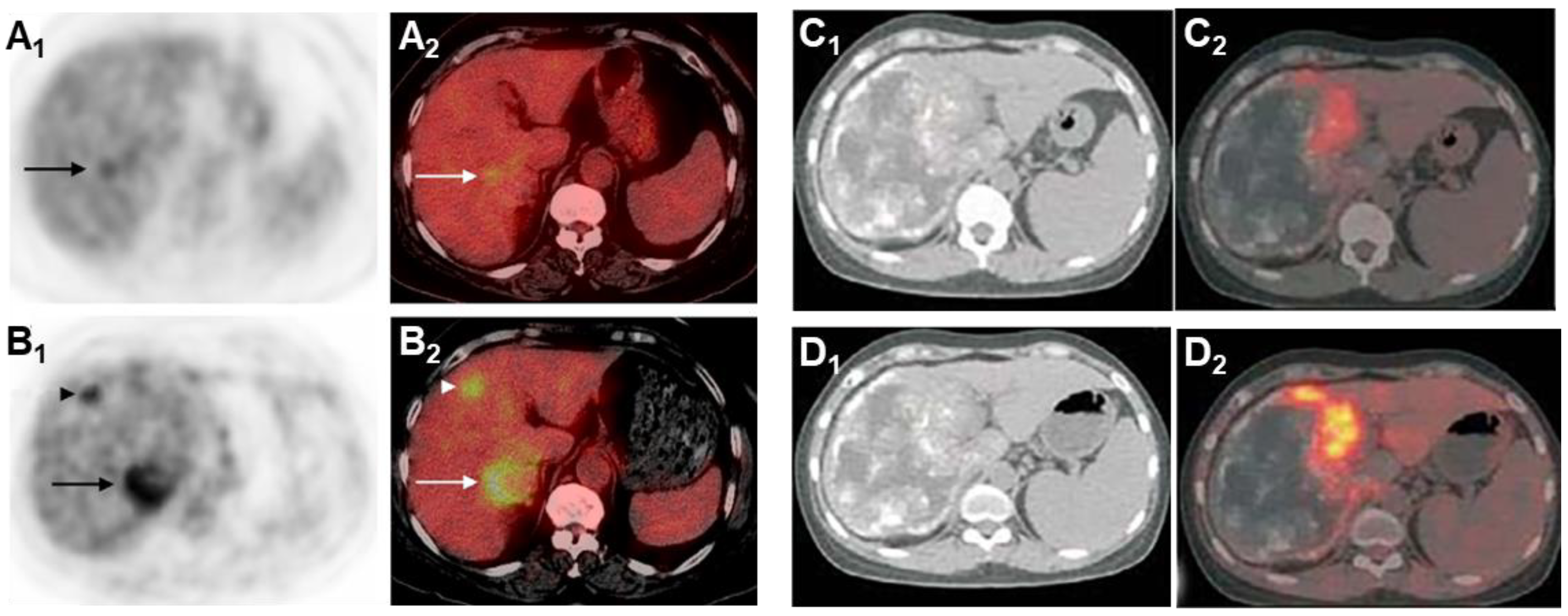 Diagnostics 15 00585 g008