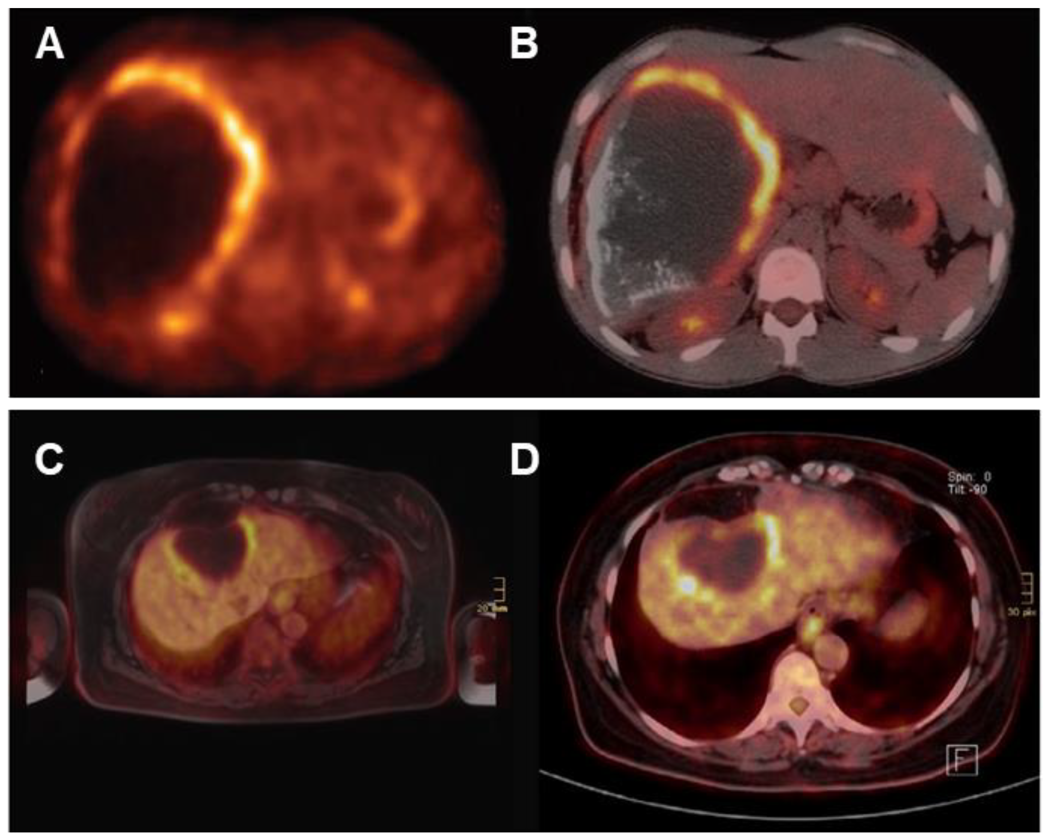Diagnostics 15 00585 g009