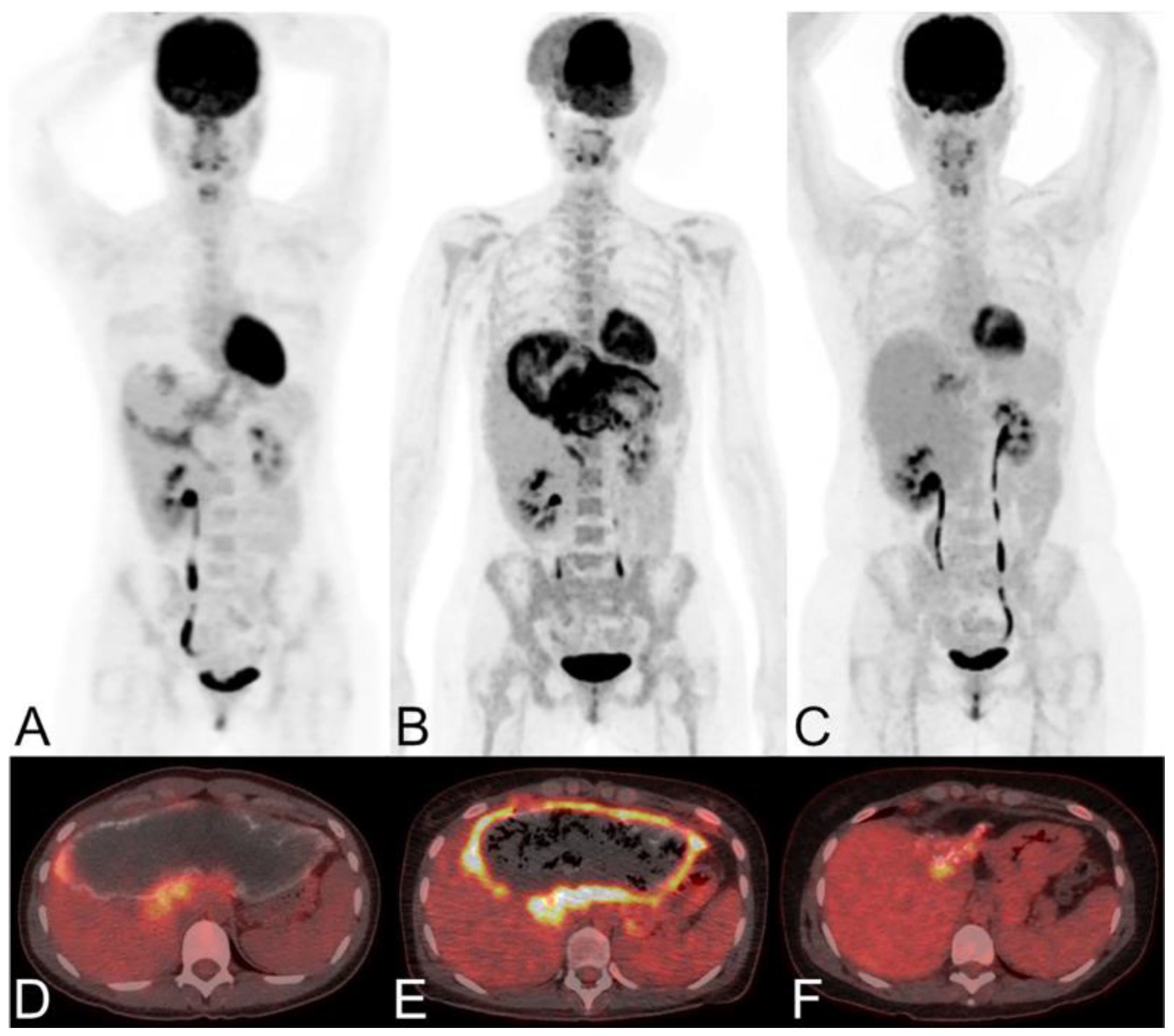 Diagnostics 15 00585 g010
