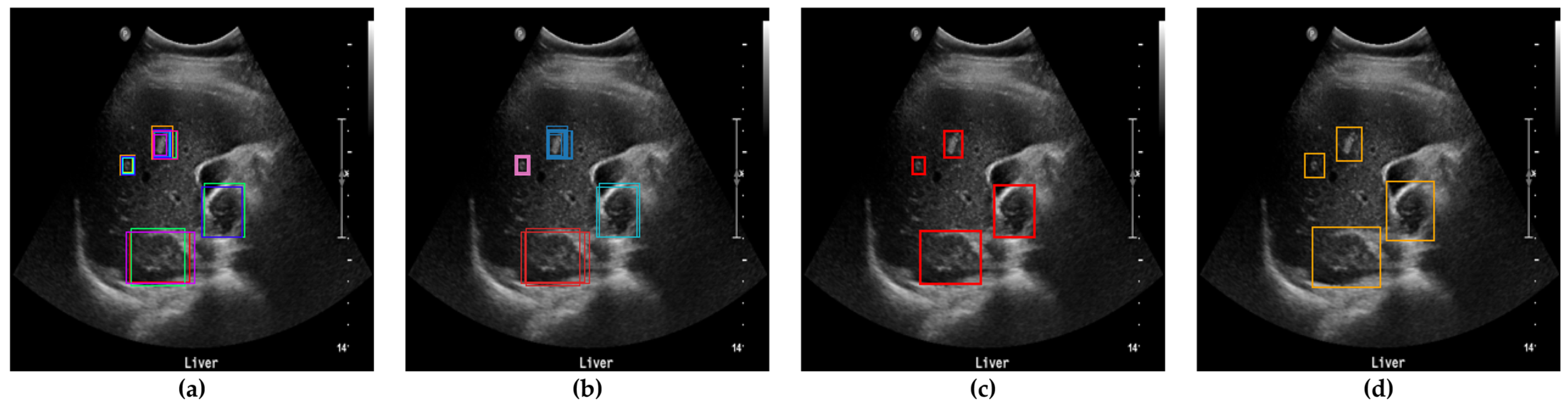 Diagnostics 15 00588 g005