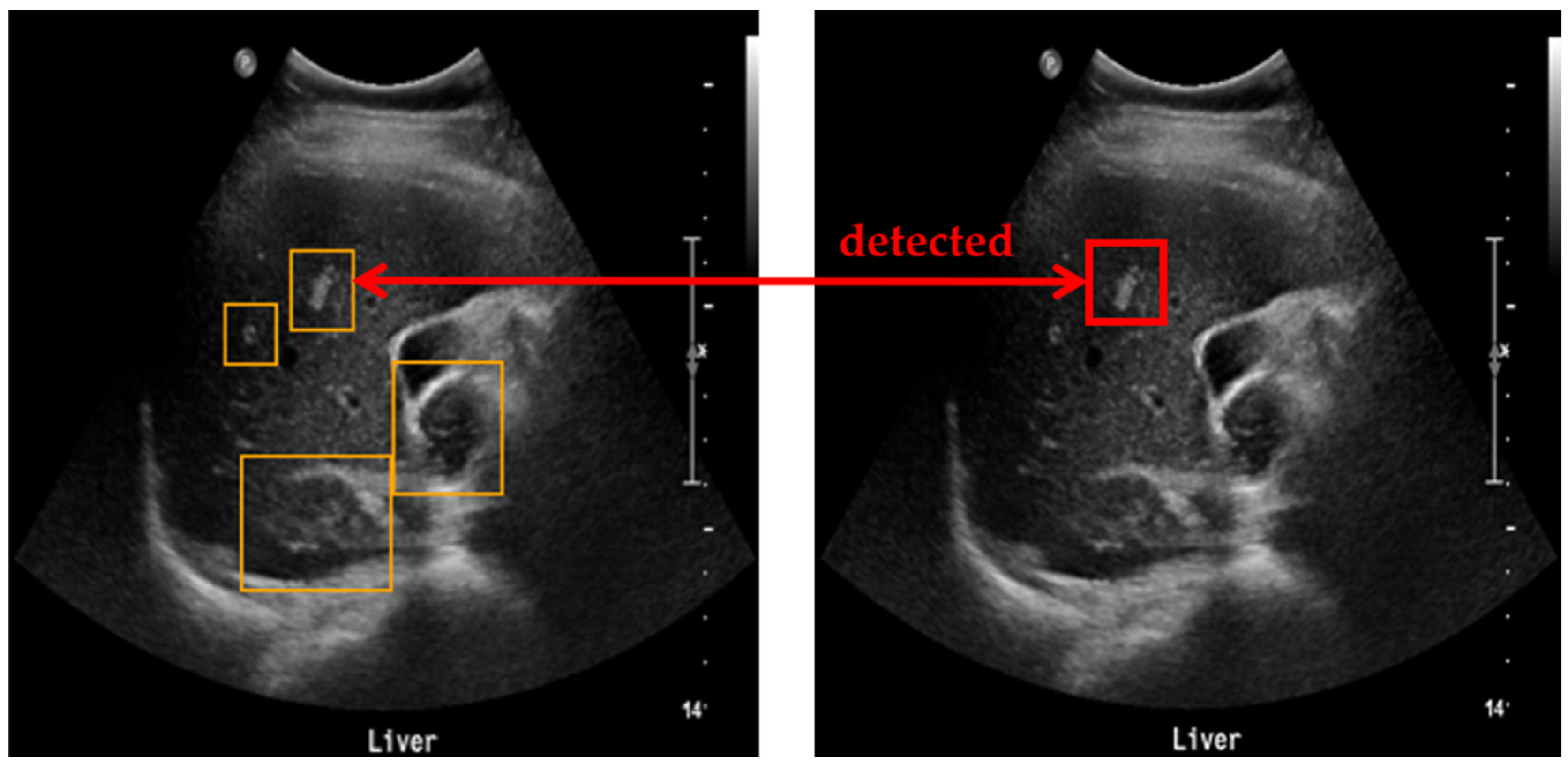 Diagnostics 15 00588 g006