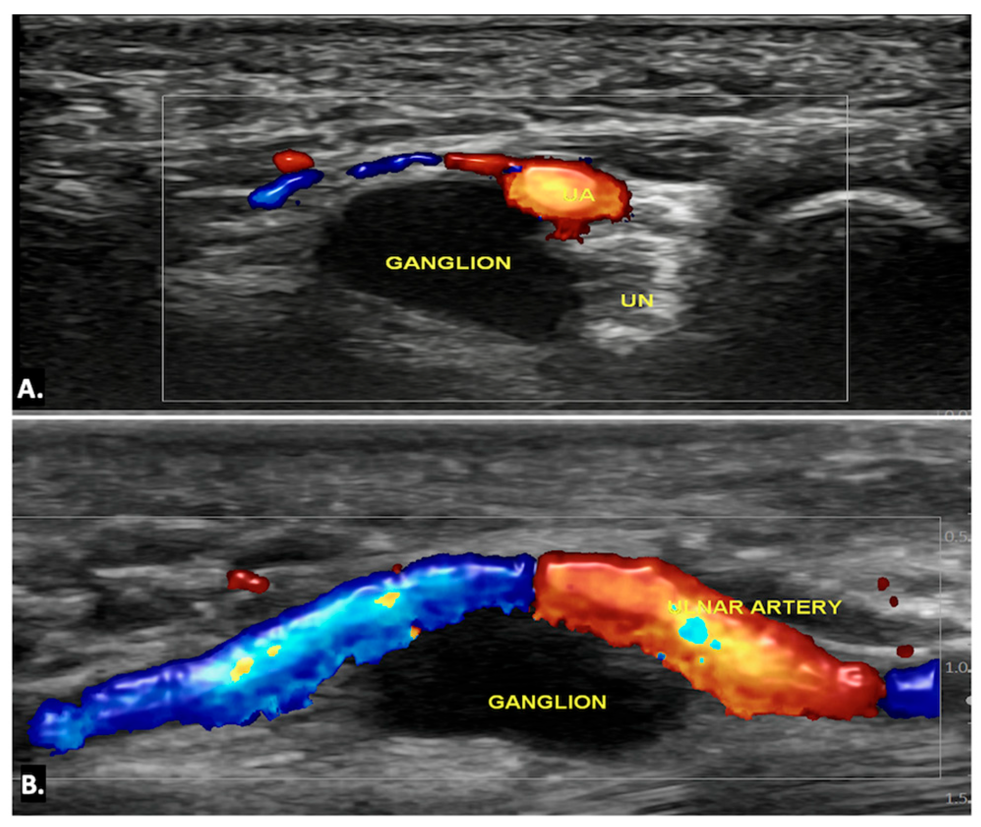 Diagnostics 15 00592 g006