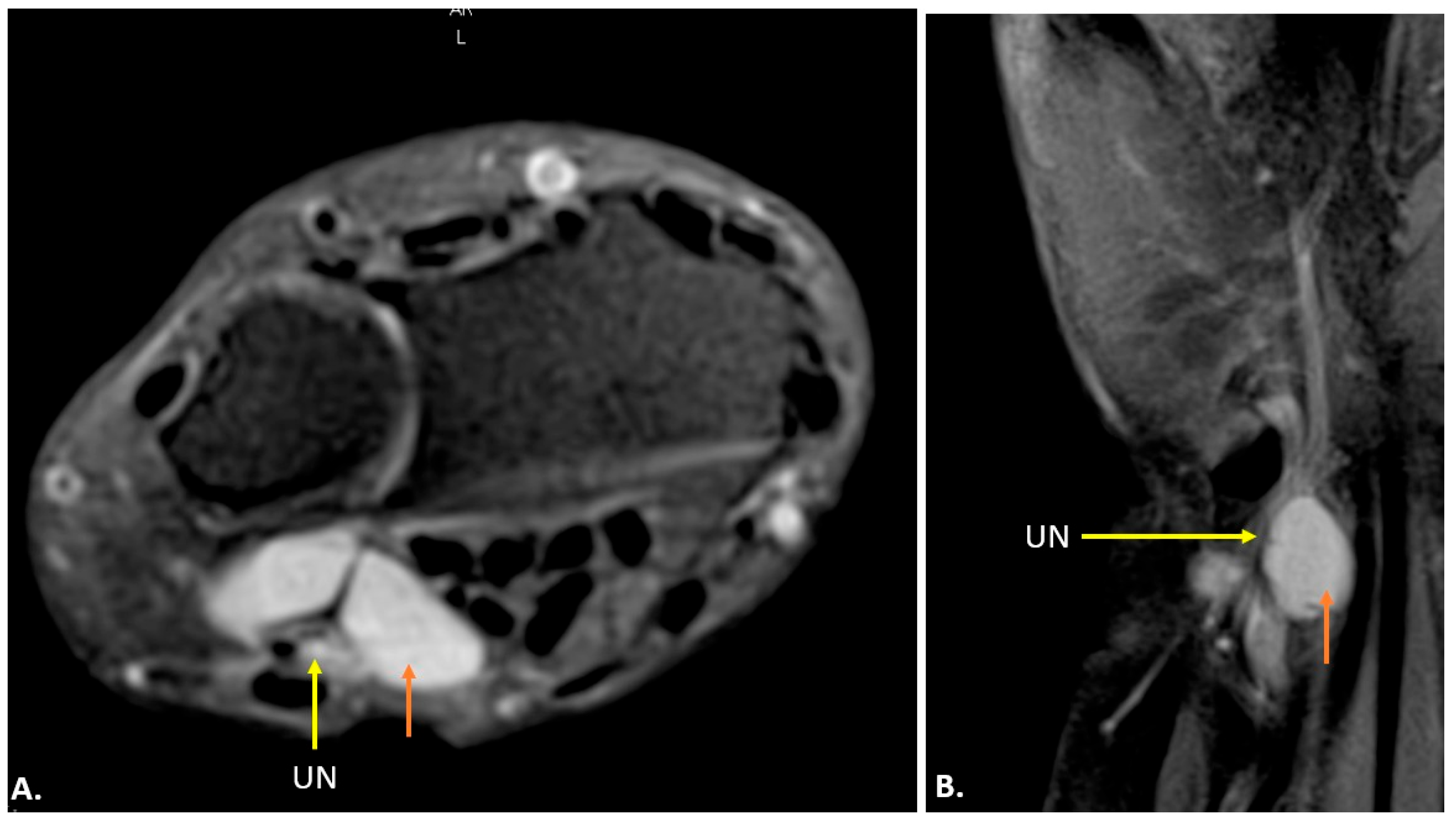 Diagnostics 15 00592 g007