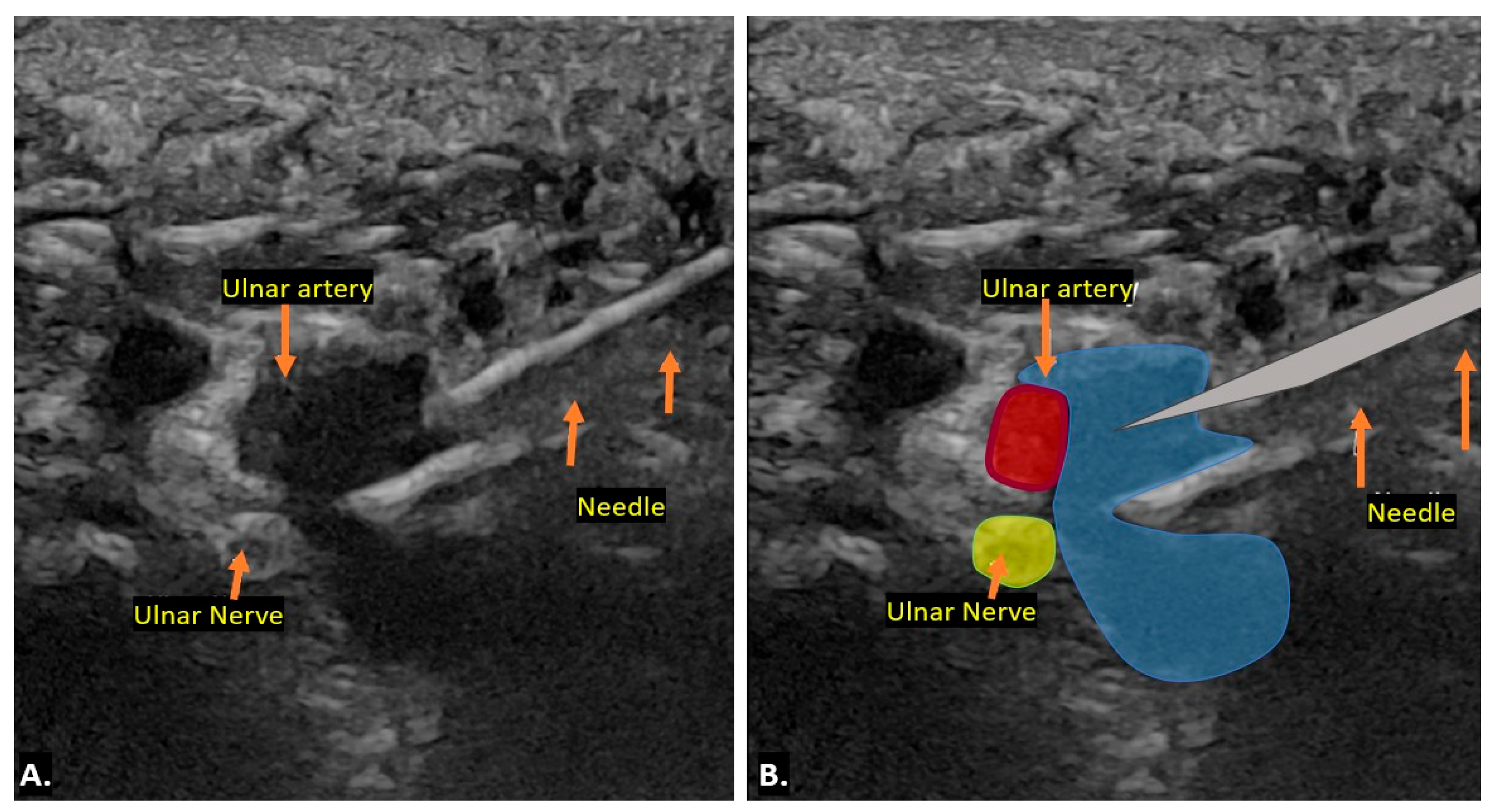Diagnostics 15 00592 g008