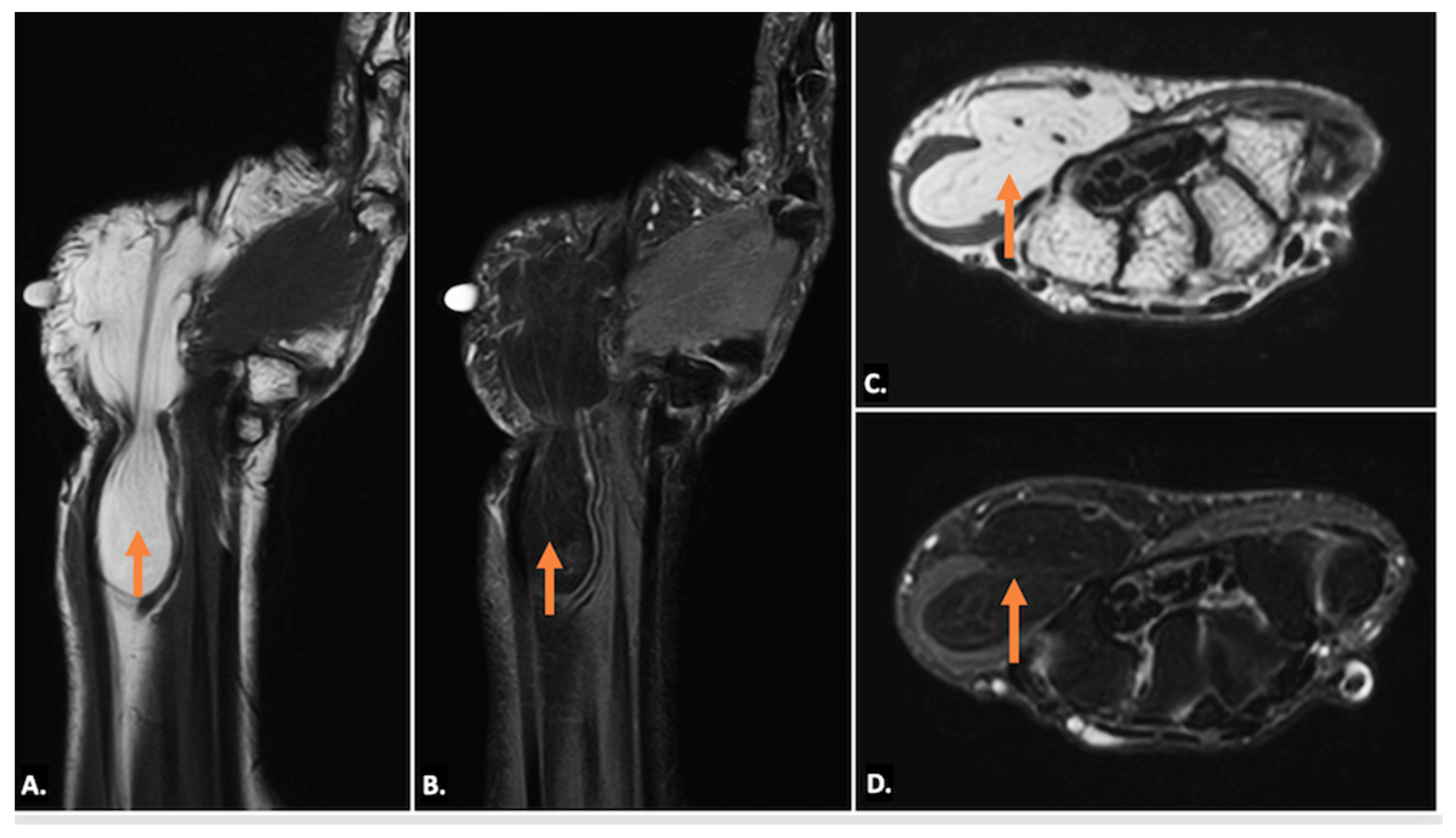 Diagnostics 15 00592 g009