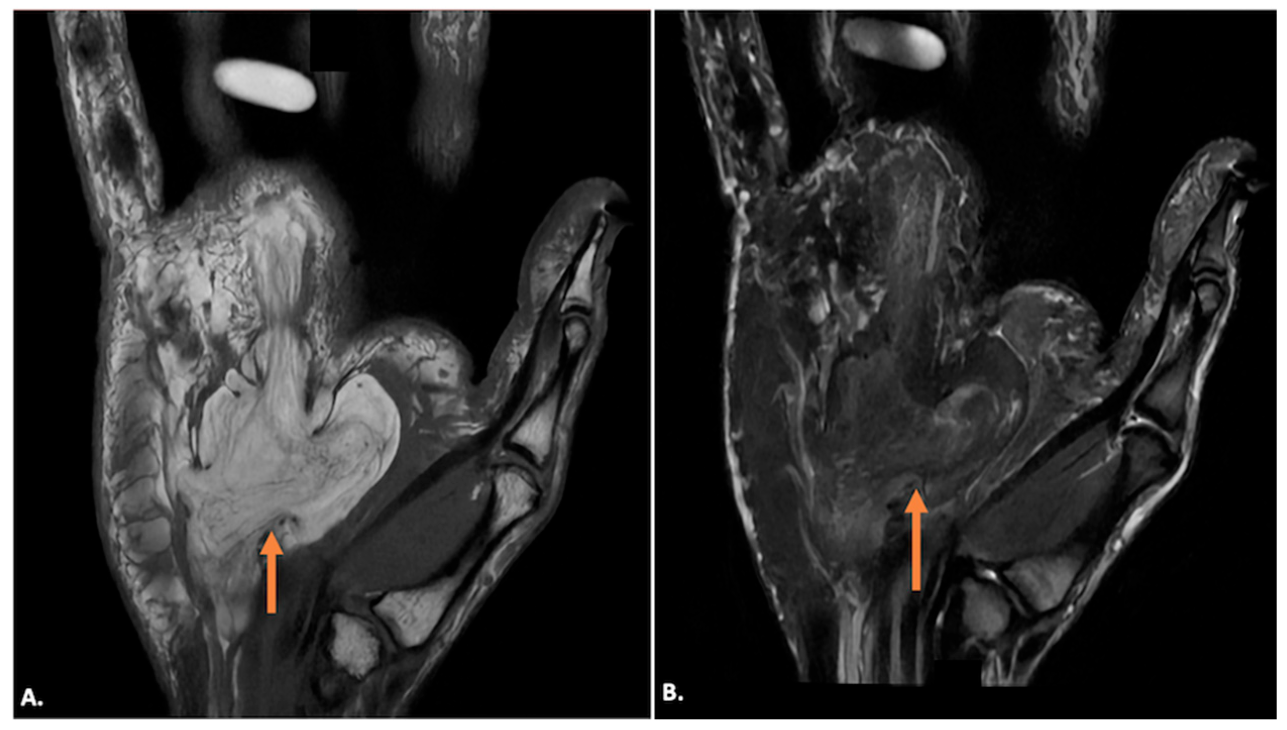 Diagnostics 15 00592 g010