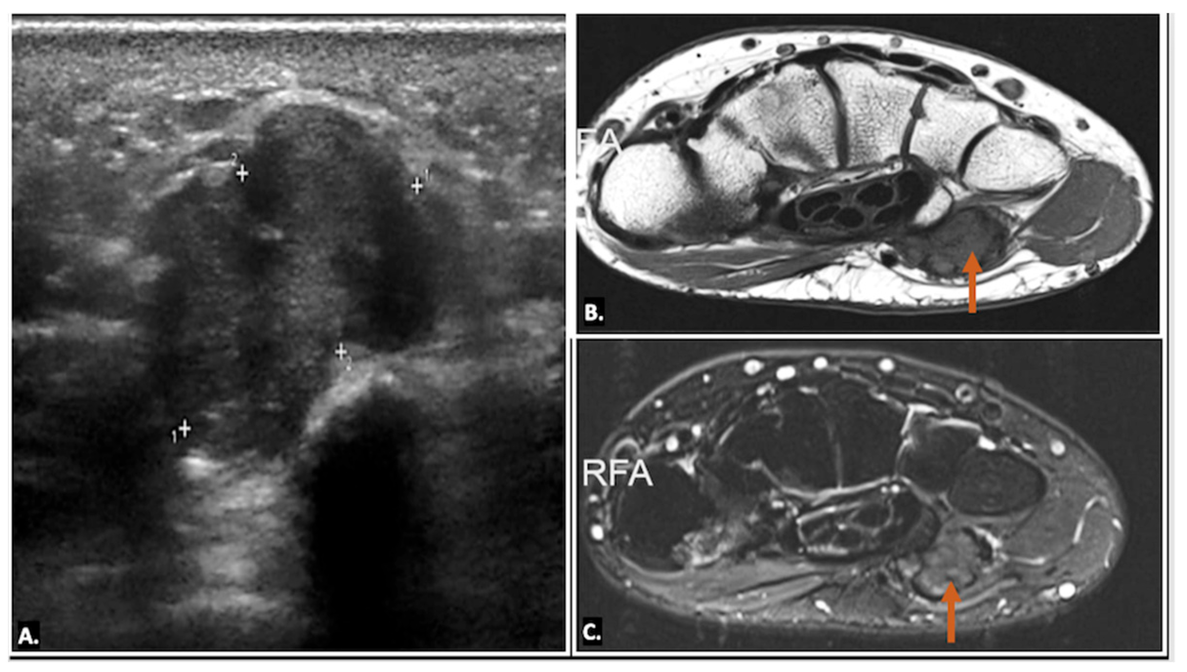 Diagnostics 15 00592 g011