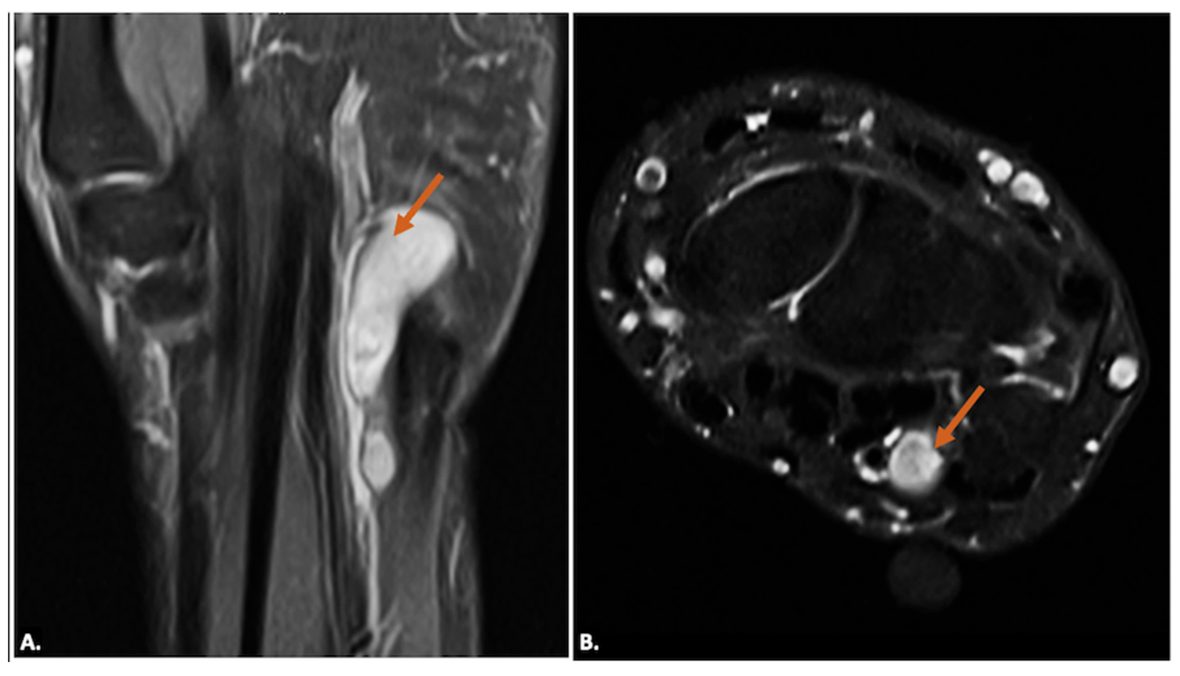 Diagnostics 15 00592 g012
