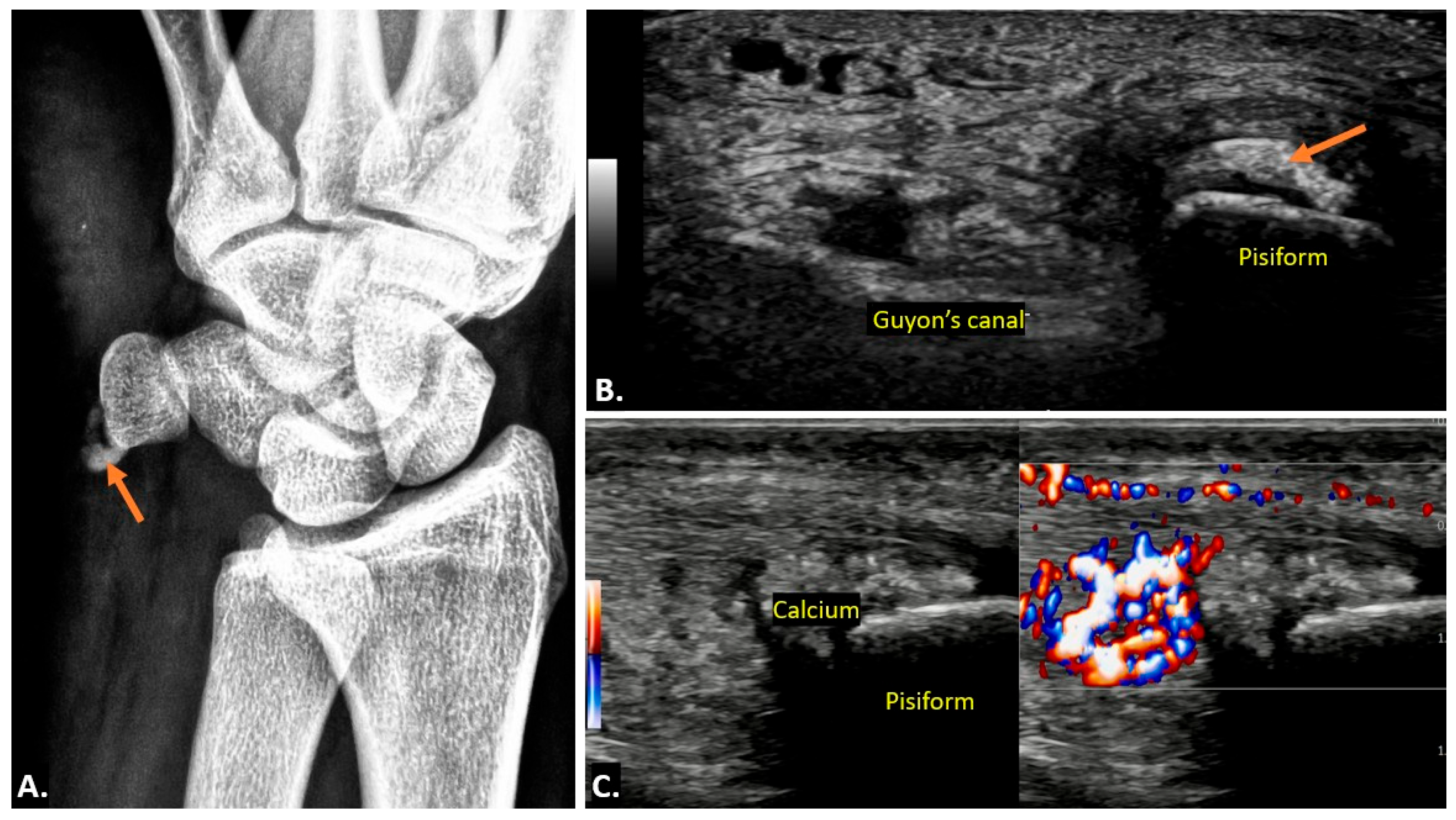 Diagnostics 15 00592 g013