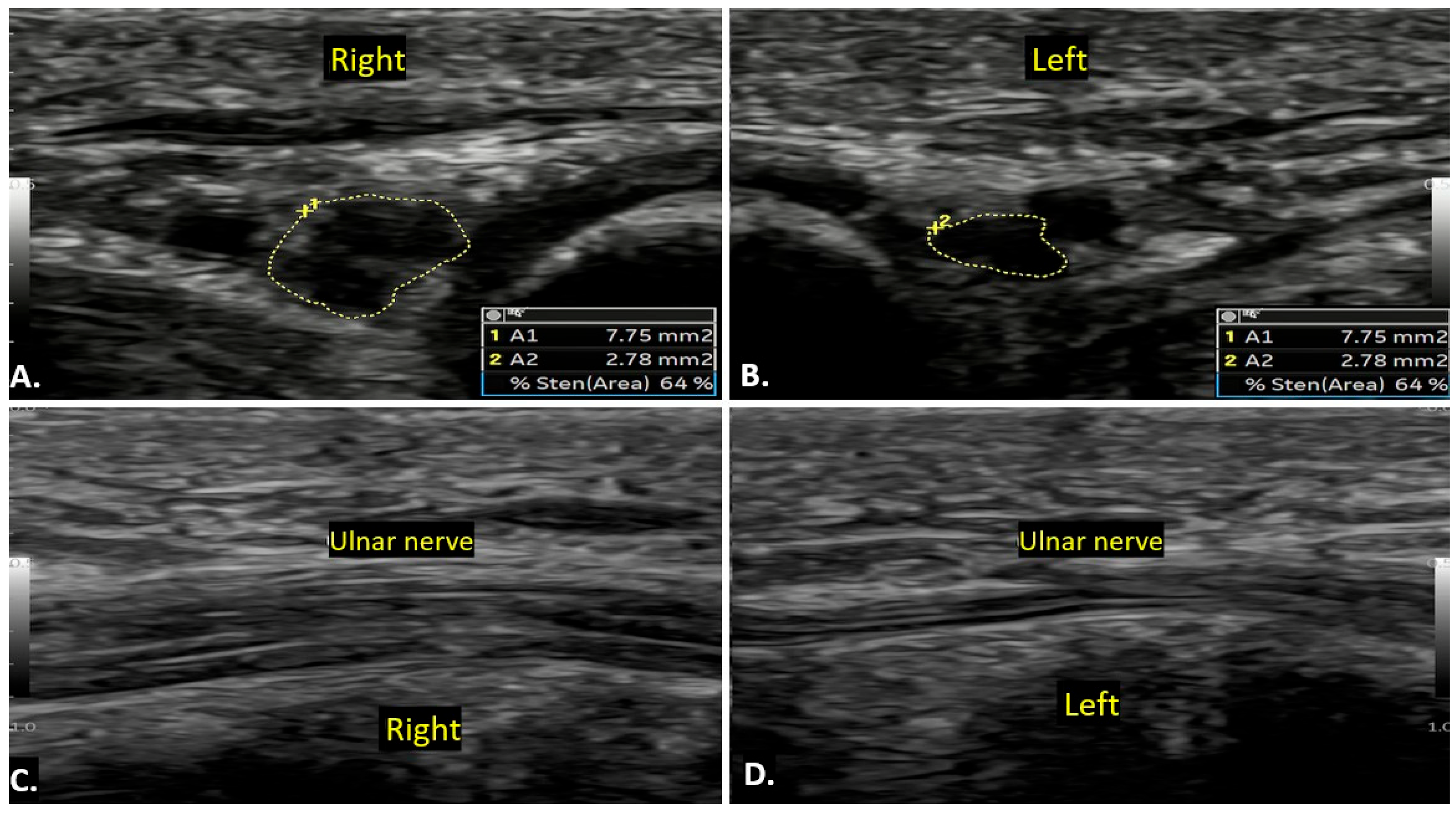 Diagnostics 15 00592 g014